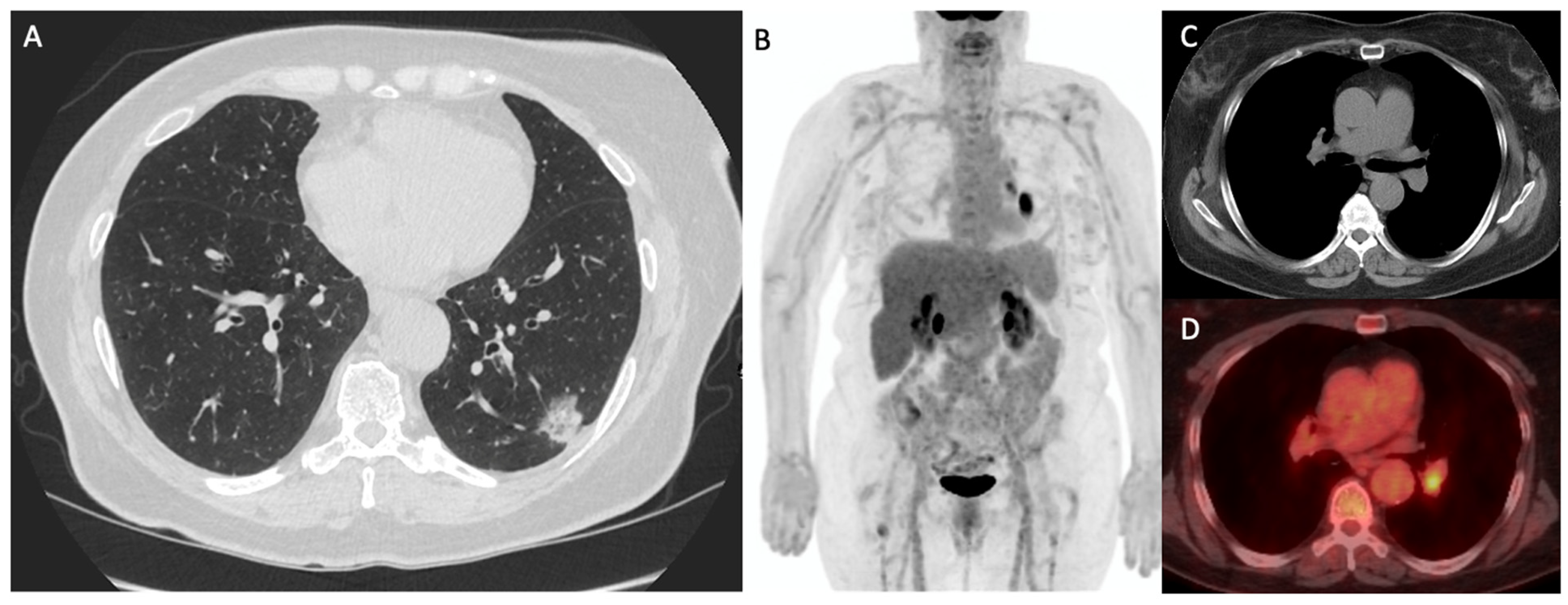 Cancers 15 02855 g002