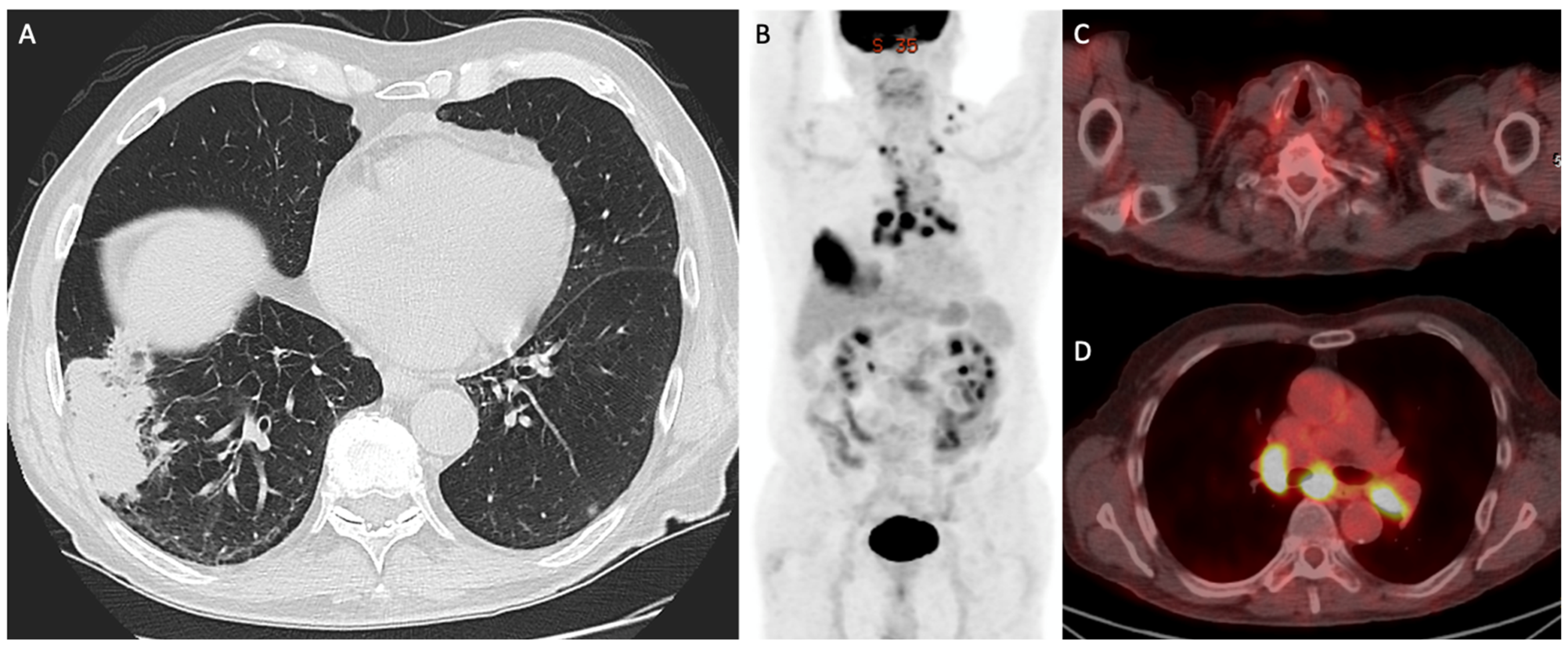 Cancers 15 02855 g003