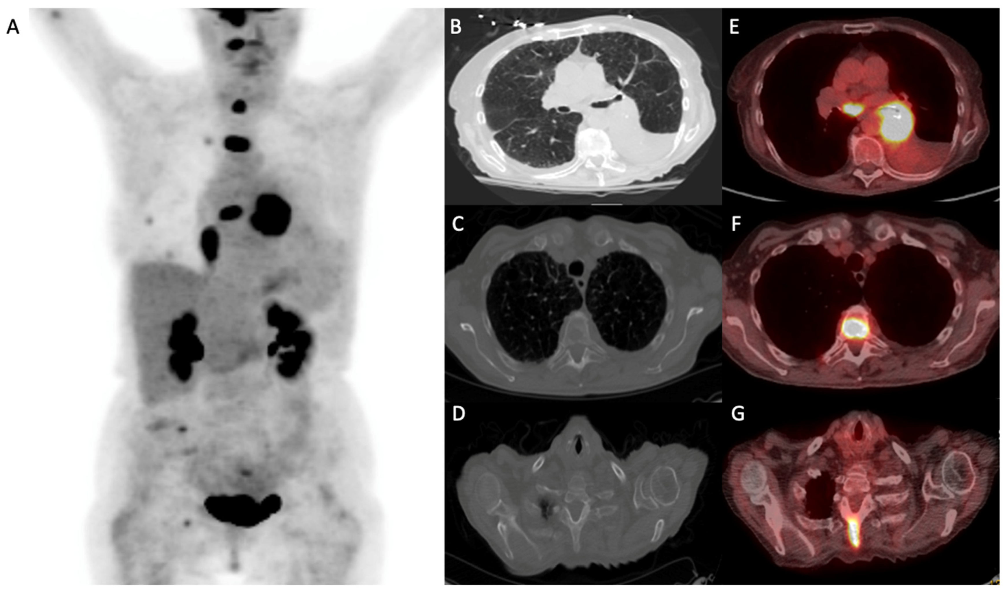 Cancers 15 02855 g004