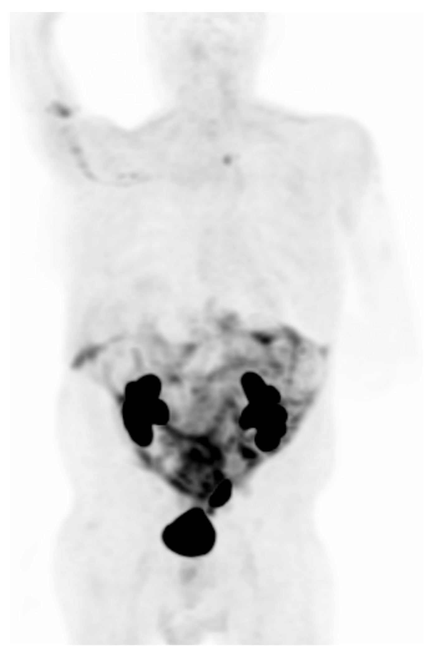 Cancers 15 02855 g005