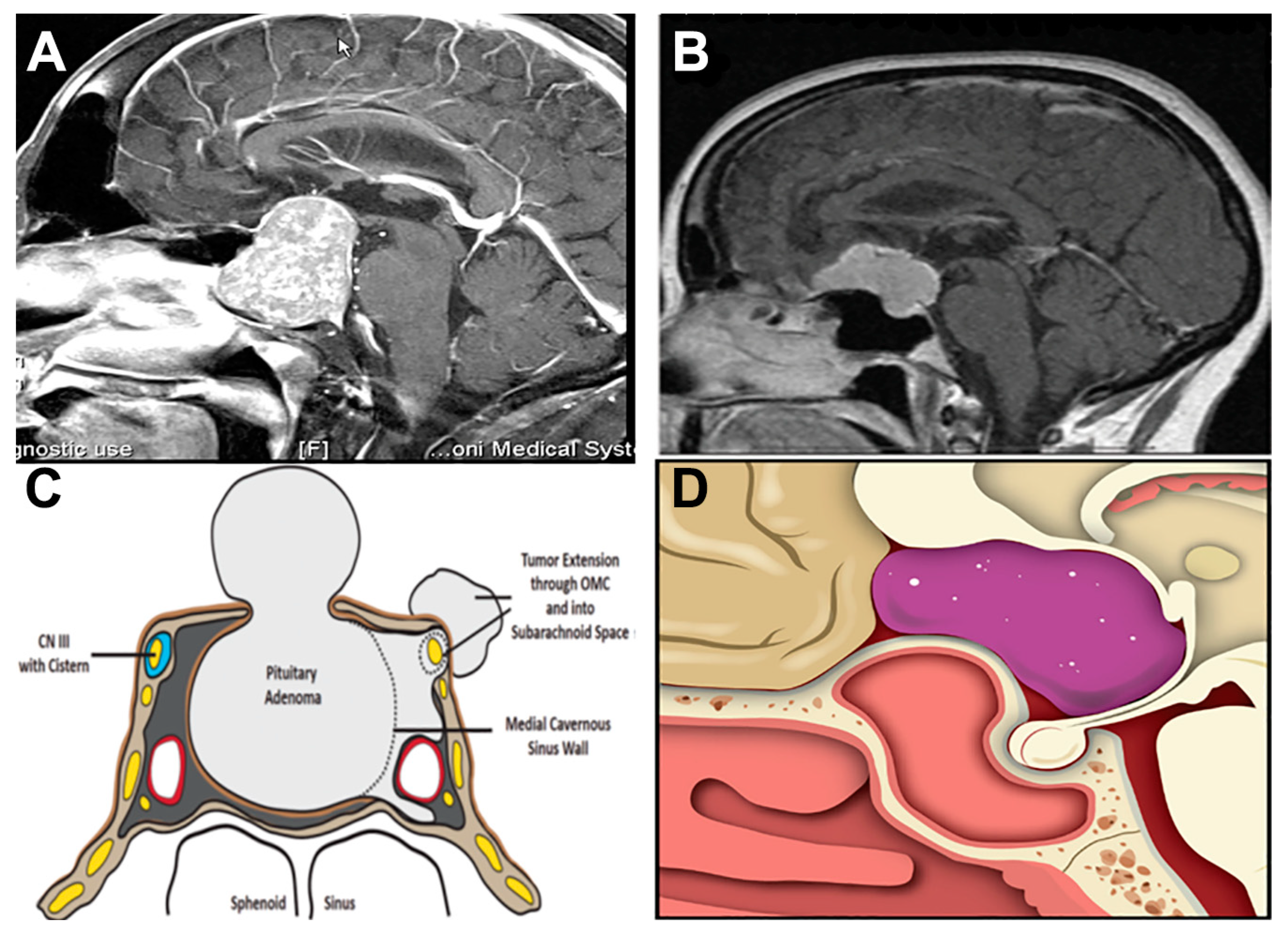 Cancers 15 02896 g001