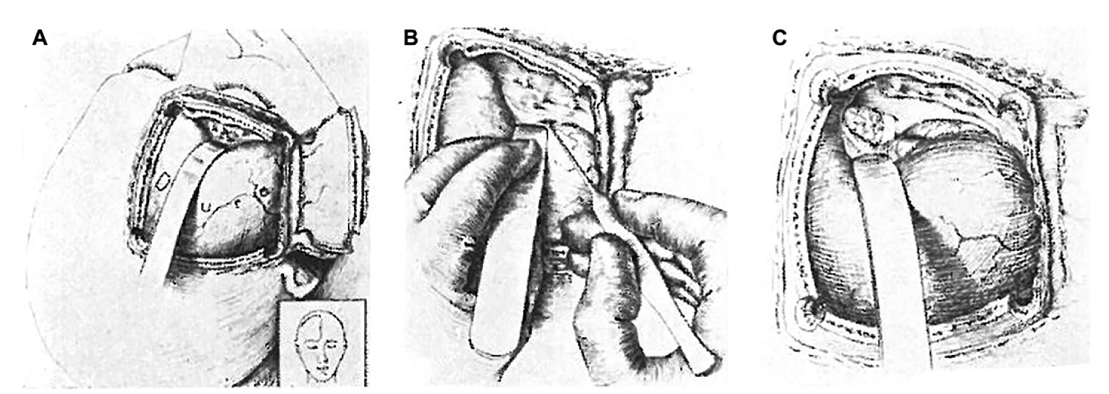 Cancers 15 02896 g003