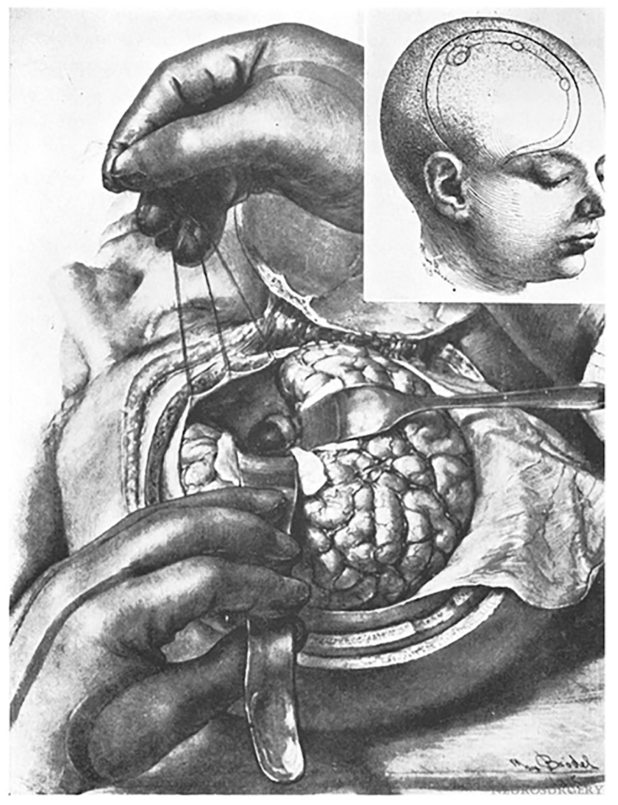 Cancers 15 02896 g006