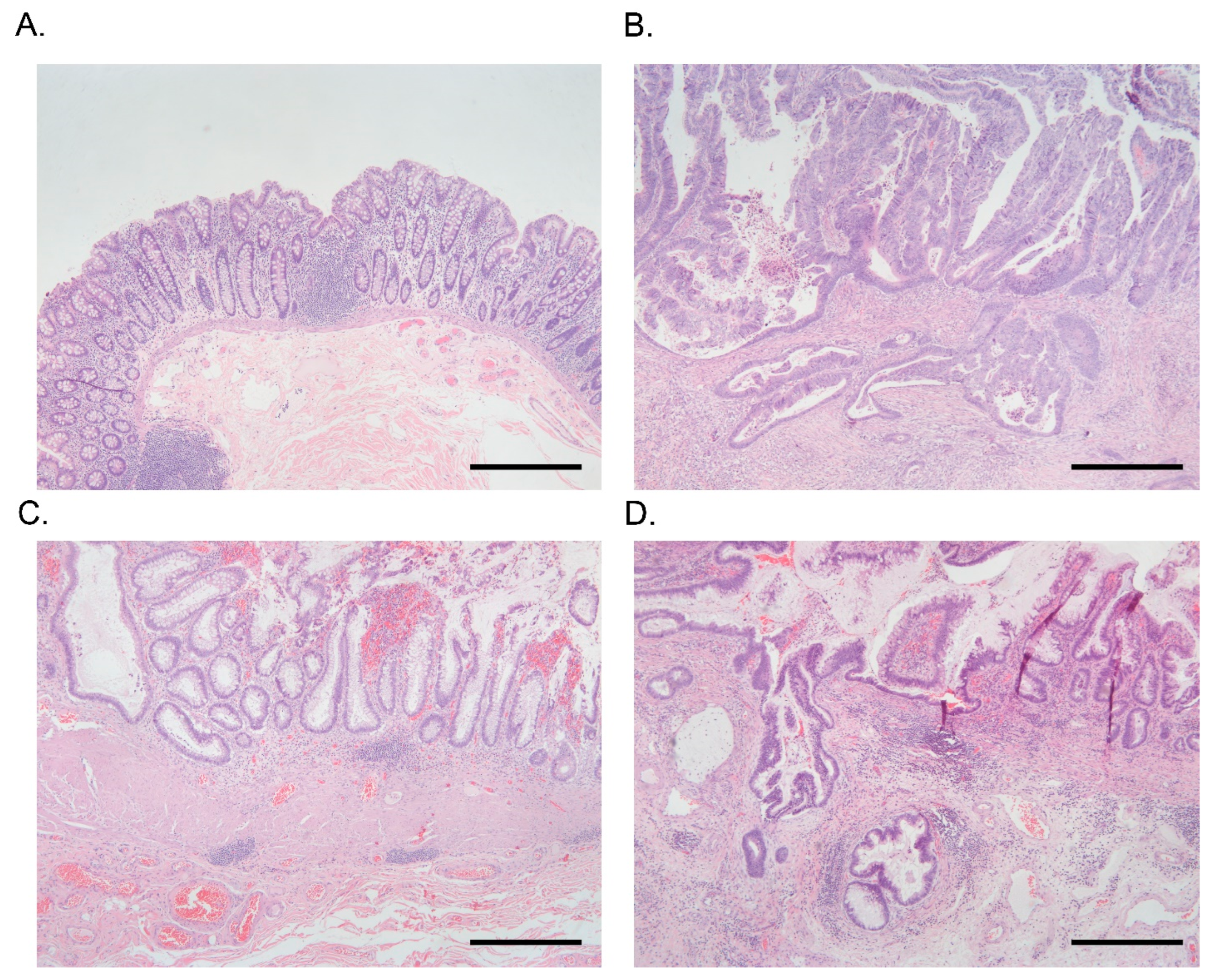 Cancers 15 02921 g001