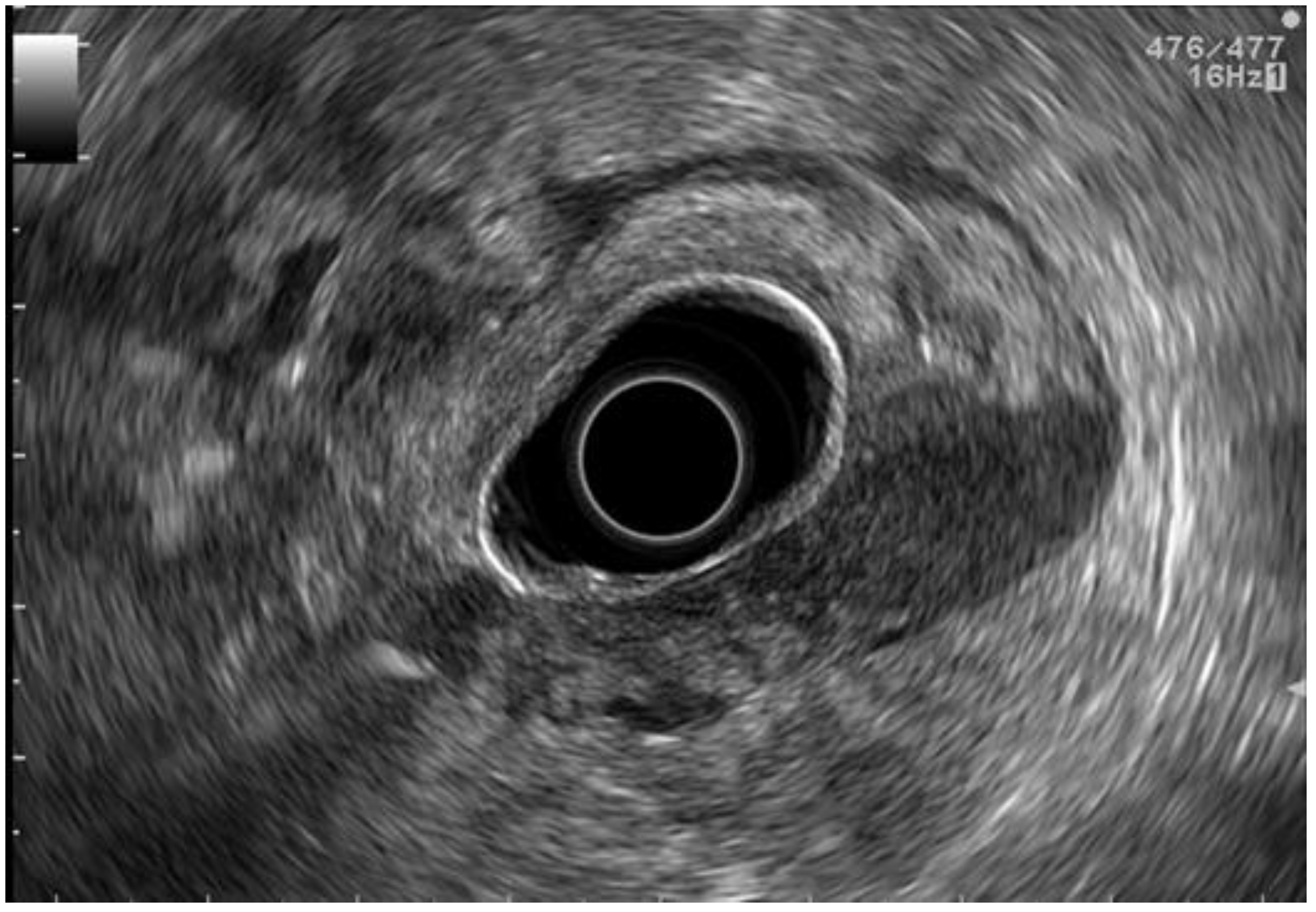 Cancers 15 02941 g001