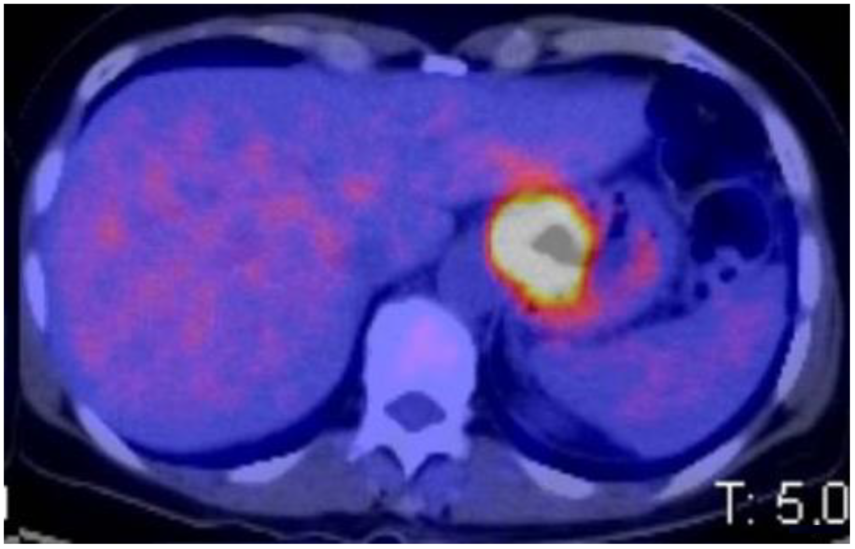 Cancers 15 02941 g002