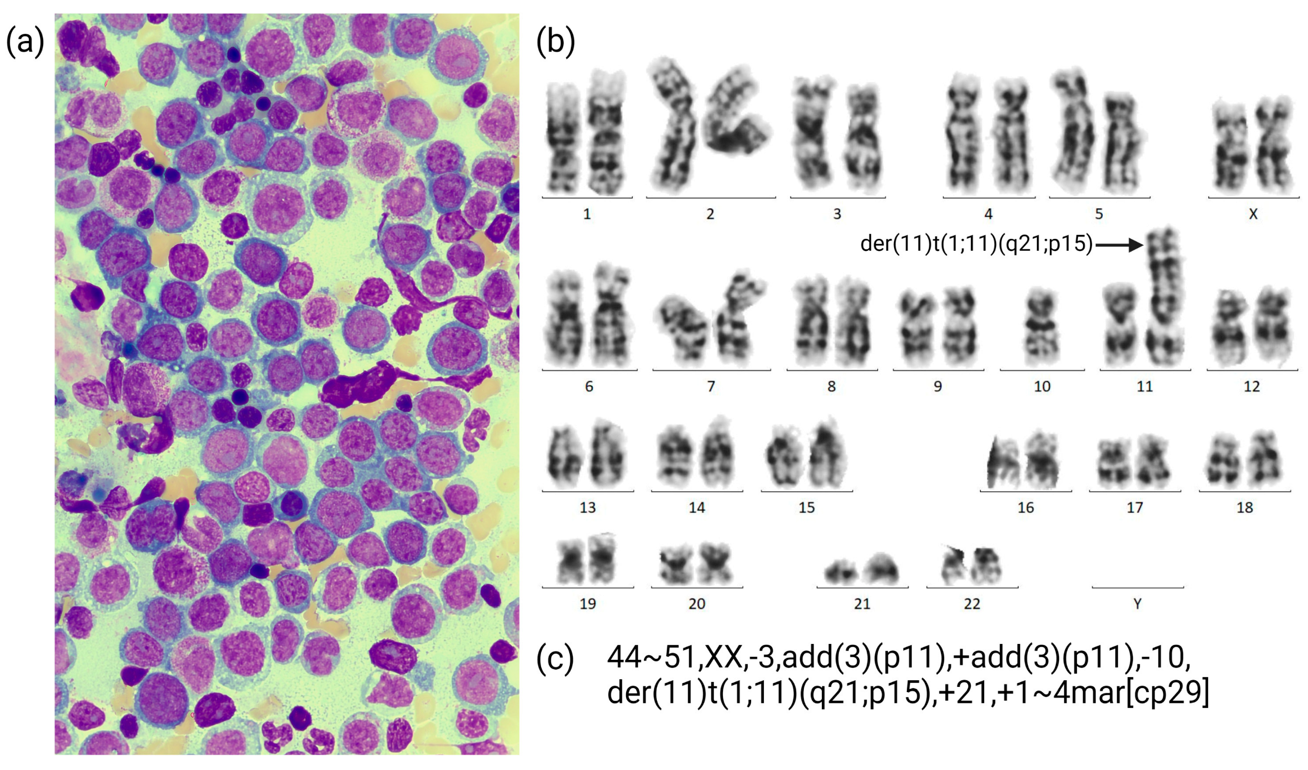 Cancers 15 02942 g001