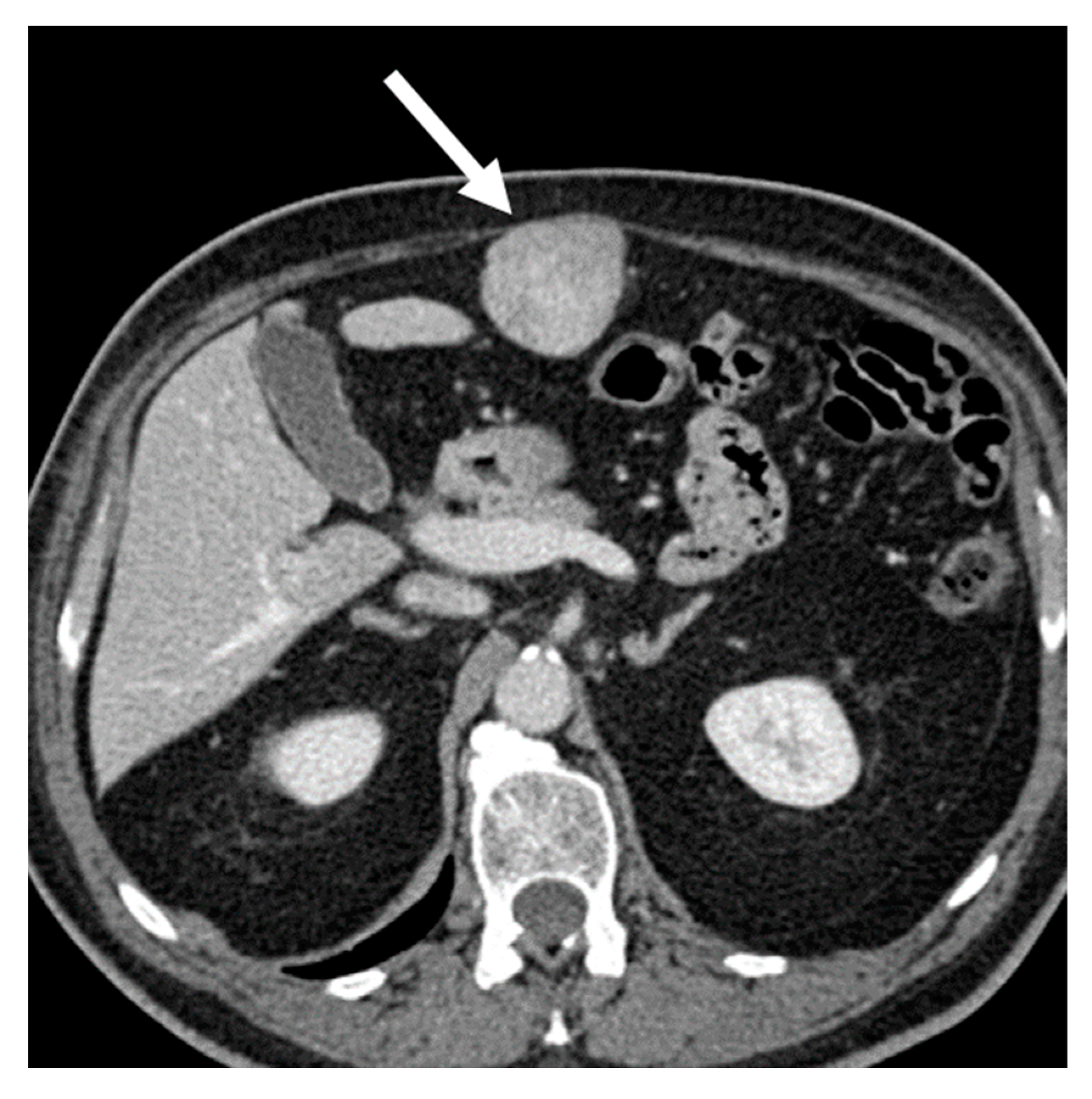 Cancers 15 02985 g005