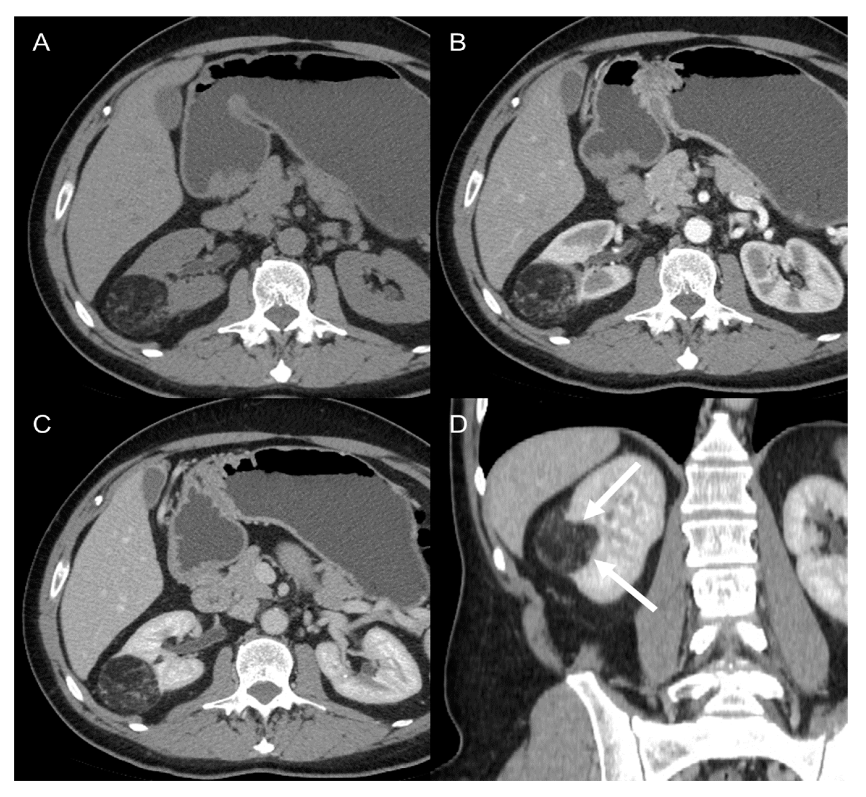 Cancers 15 02985 g007