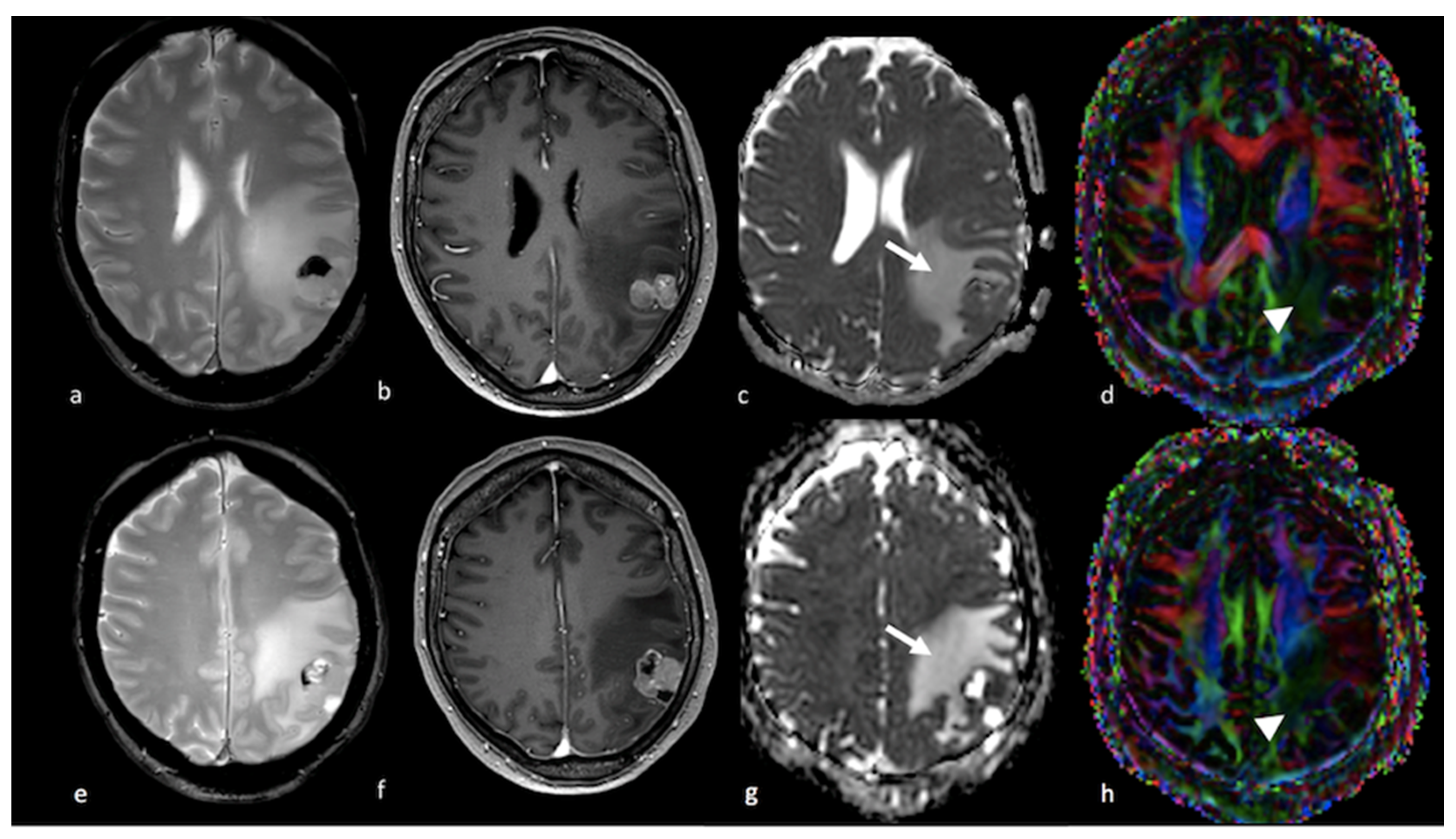 Cancers 15 02992 g004