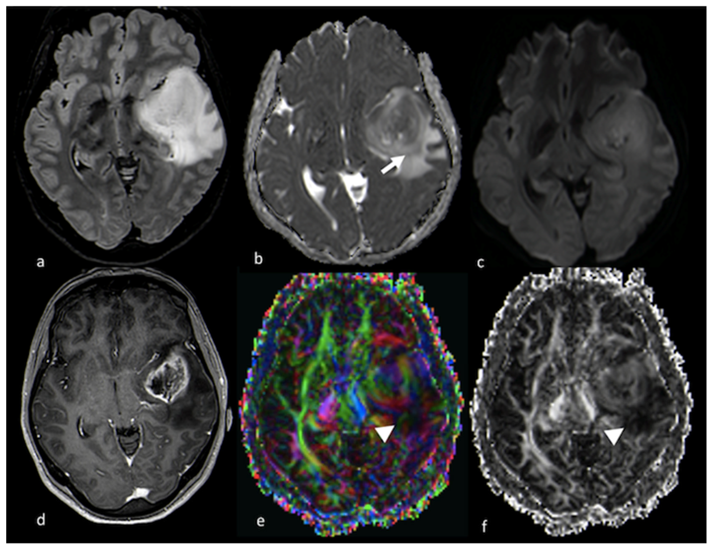 Cancers 15 02992 g005