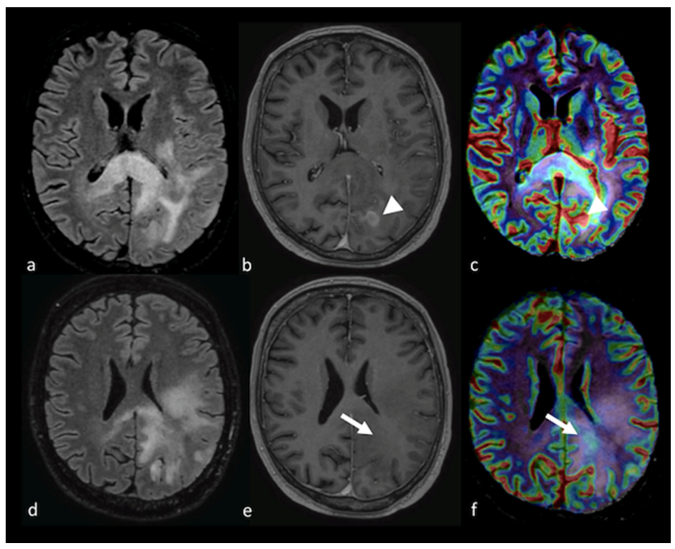 Cancers 15 02992 g006