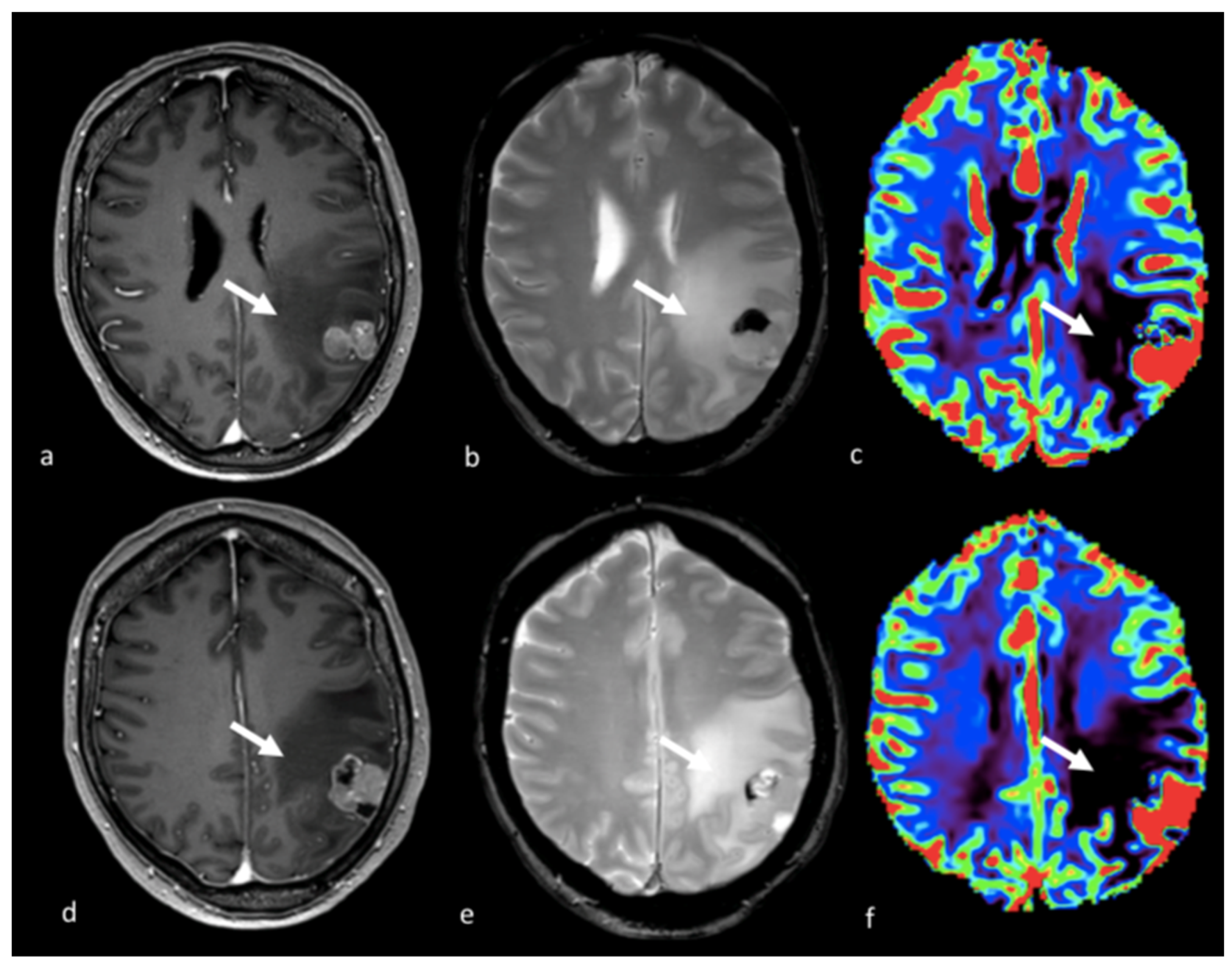 Cancers 15 02992 g007