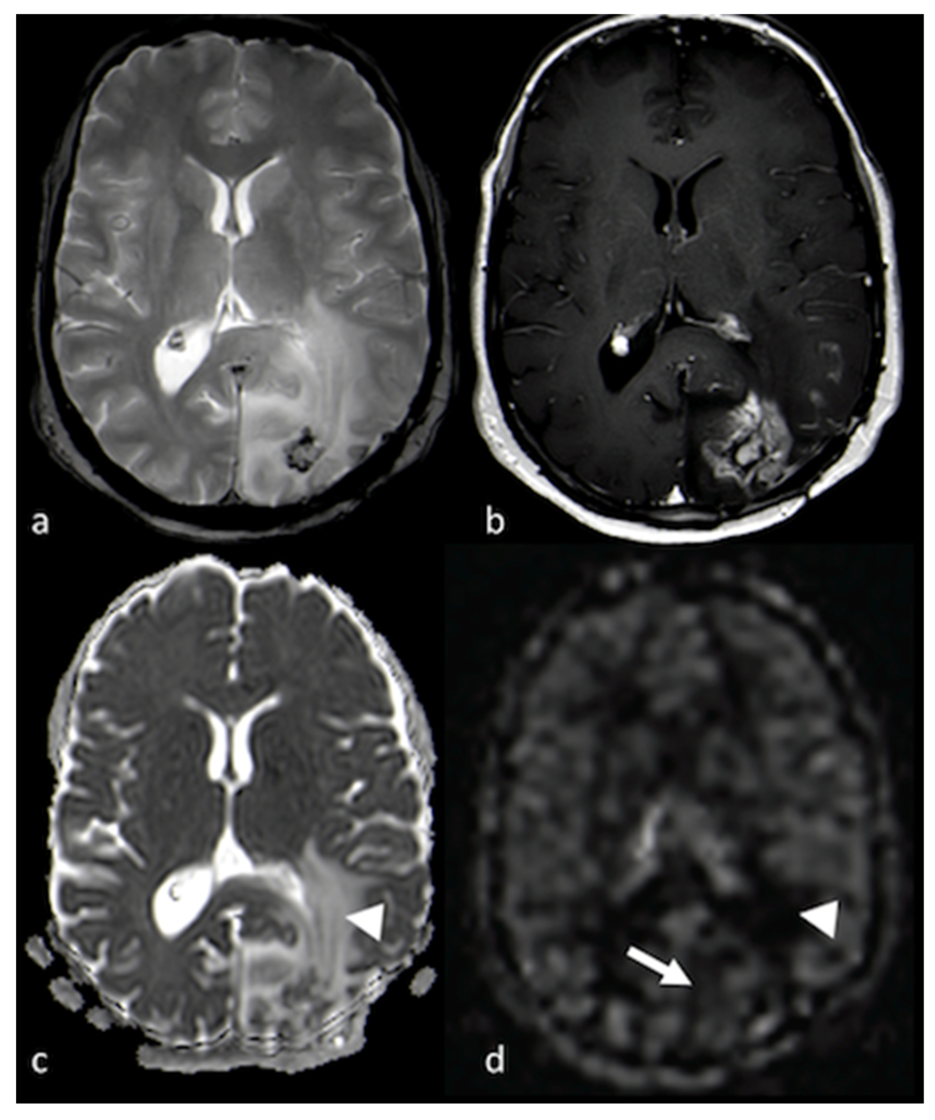 Cancers 15 02992 g009