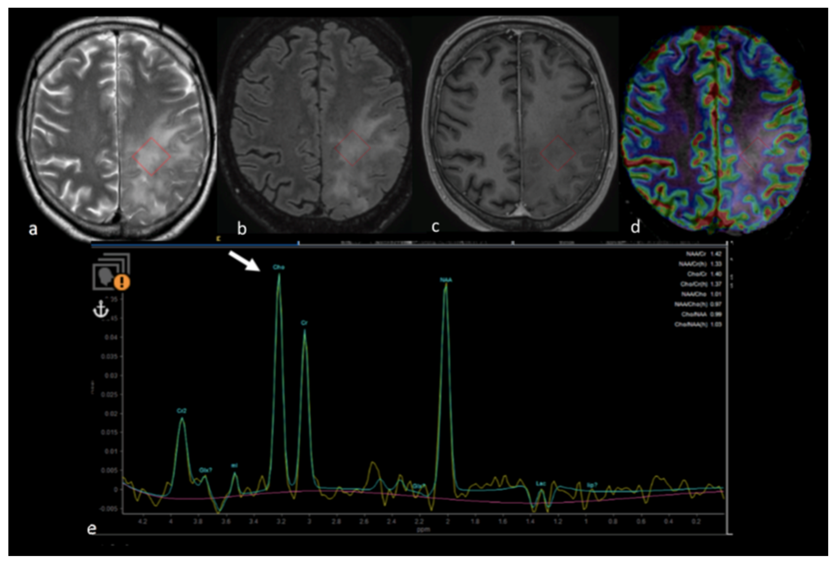 Cancers 15 02992 g010