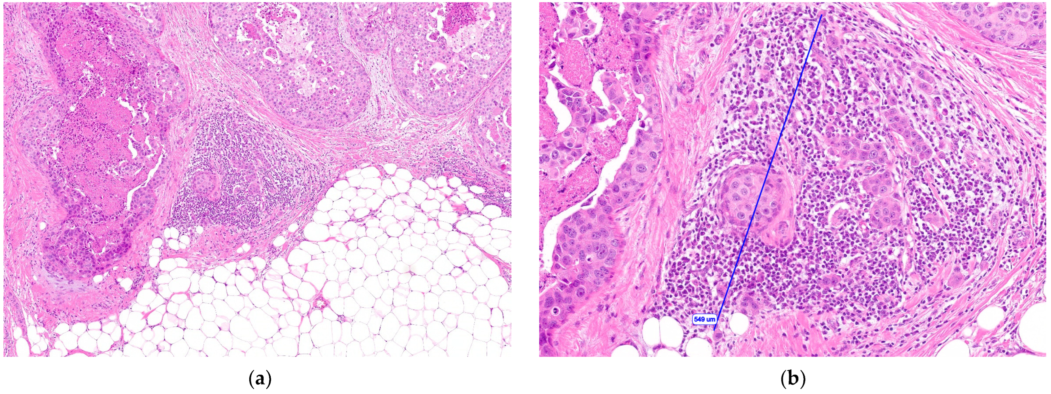 Cancers 15 03007 g001