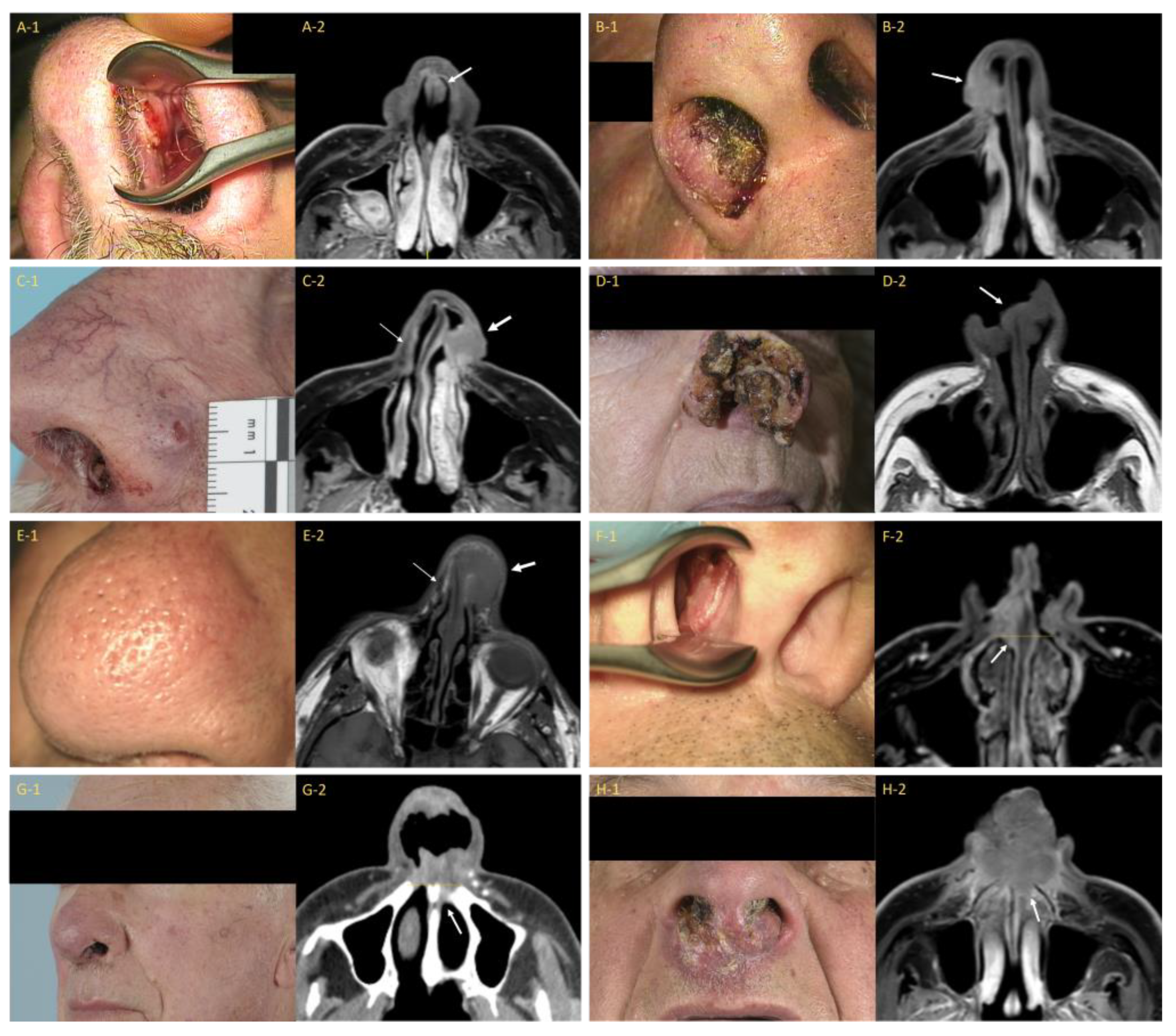 Cancers 15 03028 g003