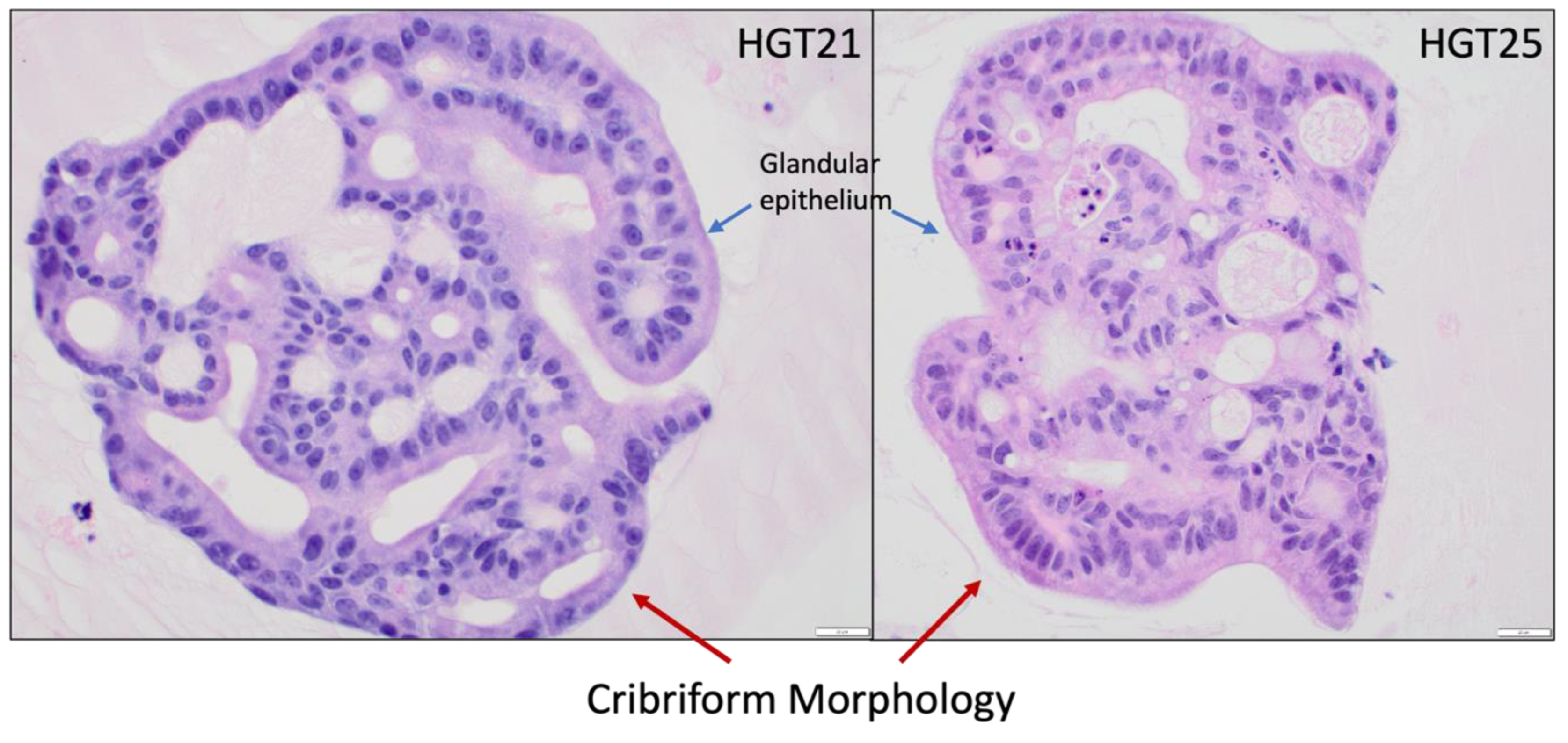 Cancers 15 03036 g002