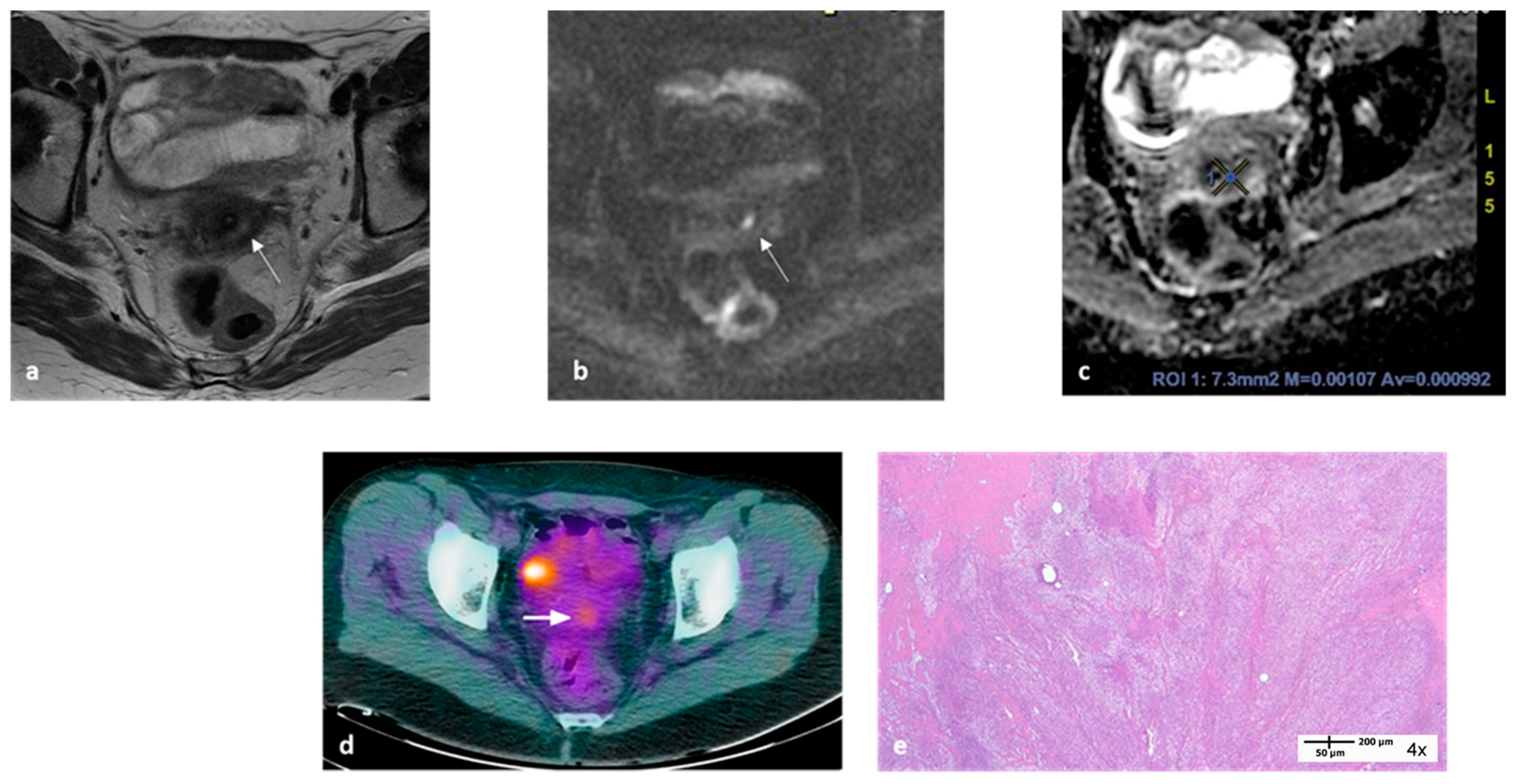 Cancers 15 03071 g002