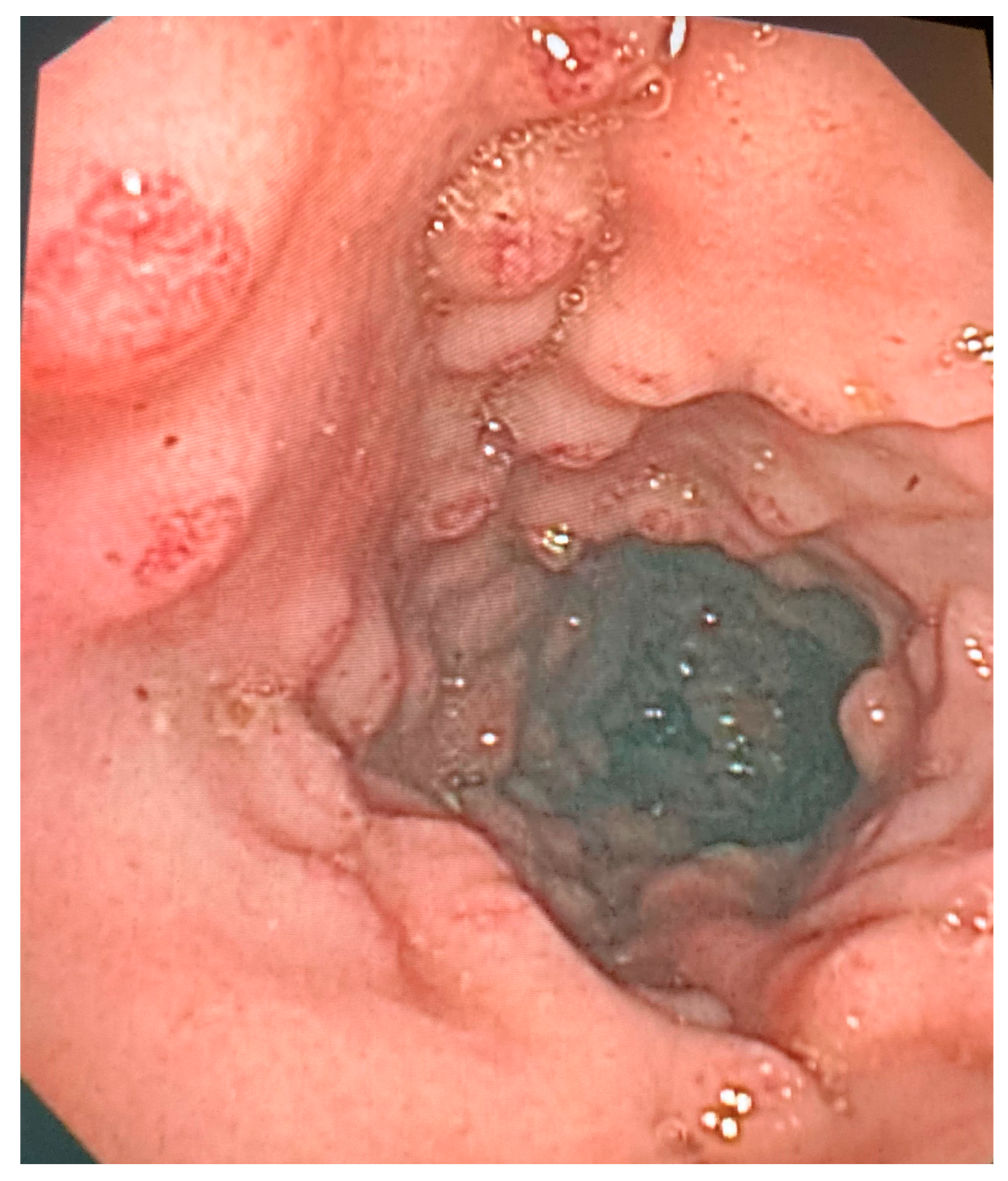 Cancers 15 03122 g002