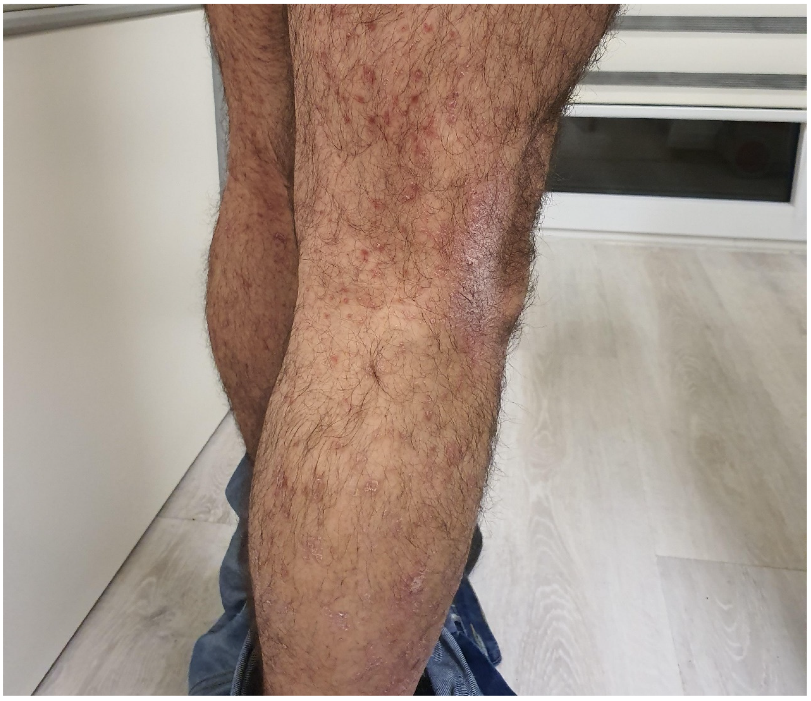 Cancers 15 03126 g003