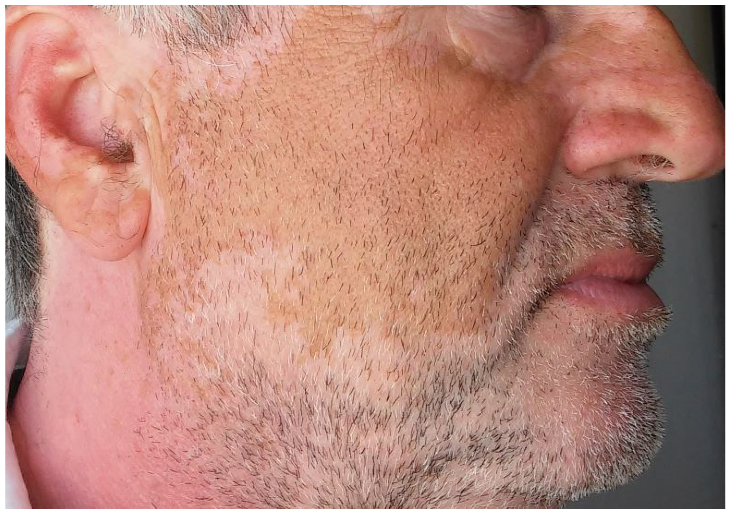 Cancers 15 03126 g004