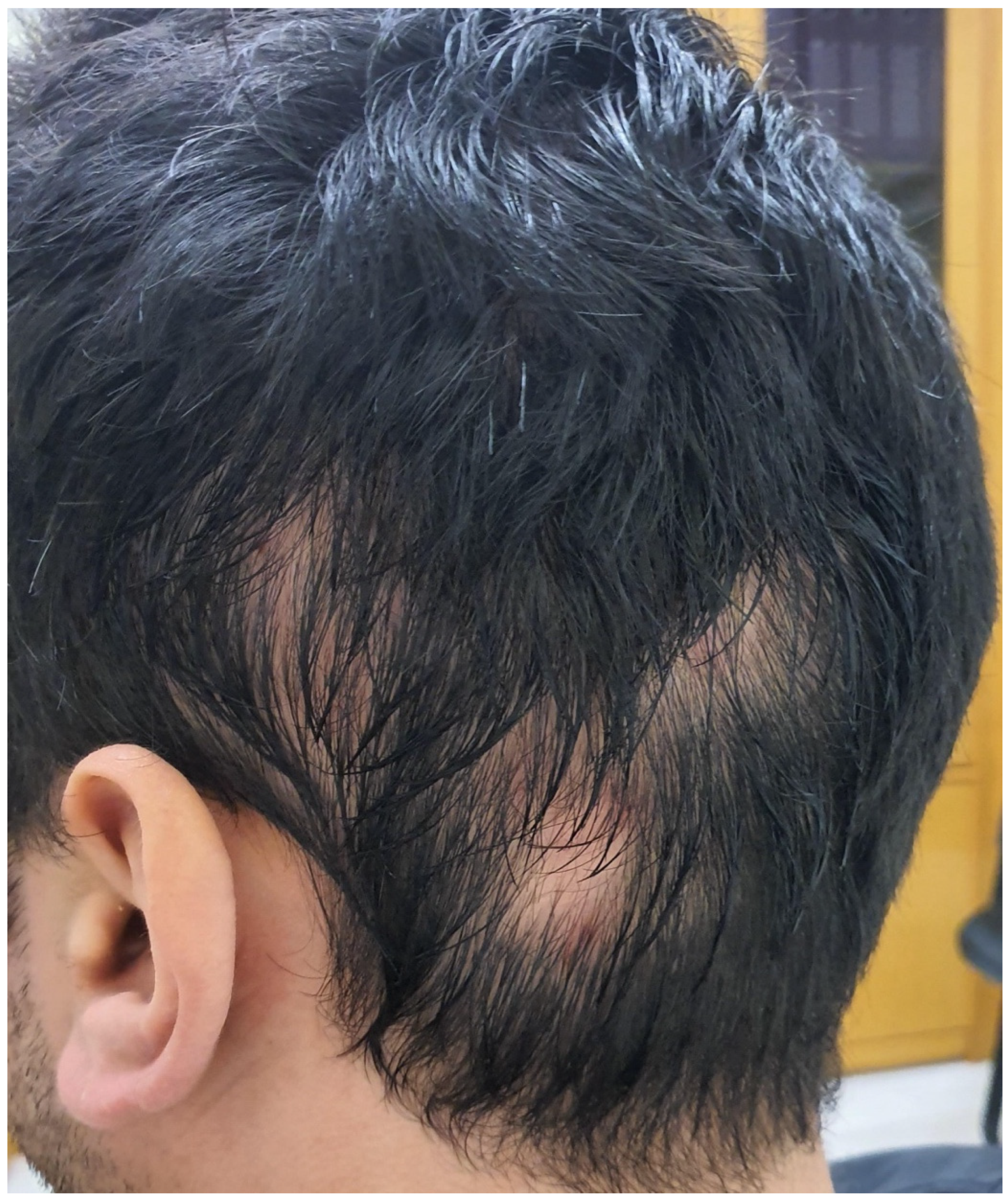 Cancers 15 03126 g005