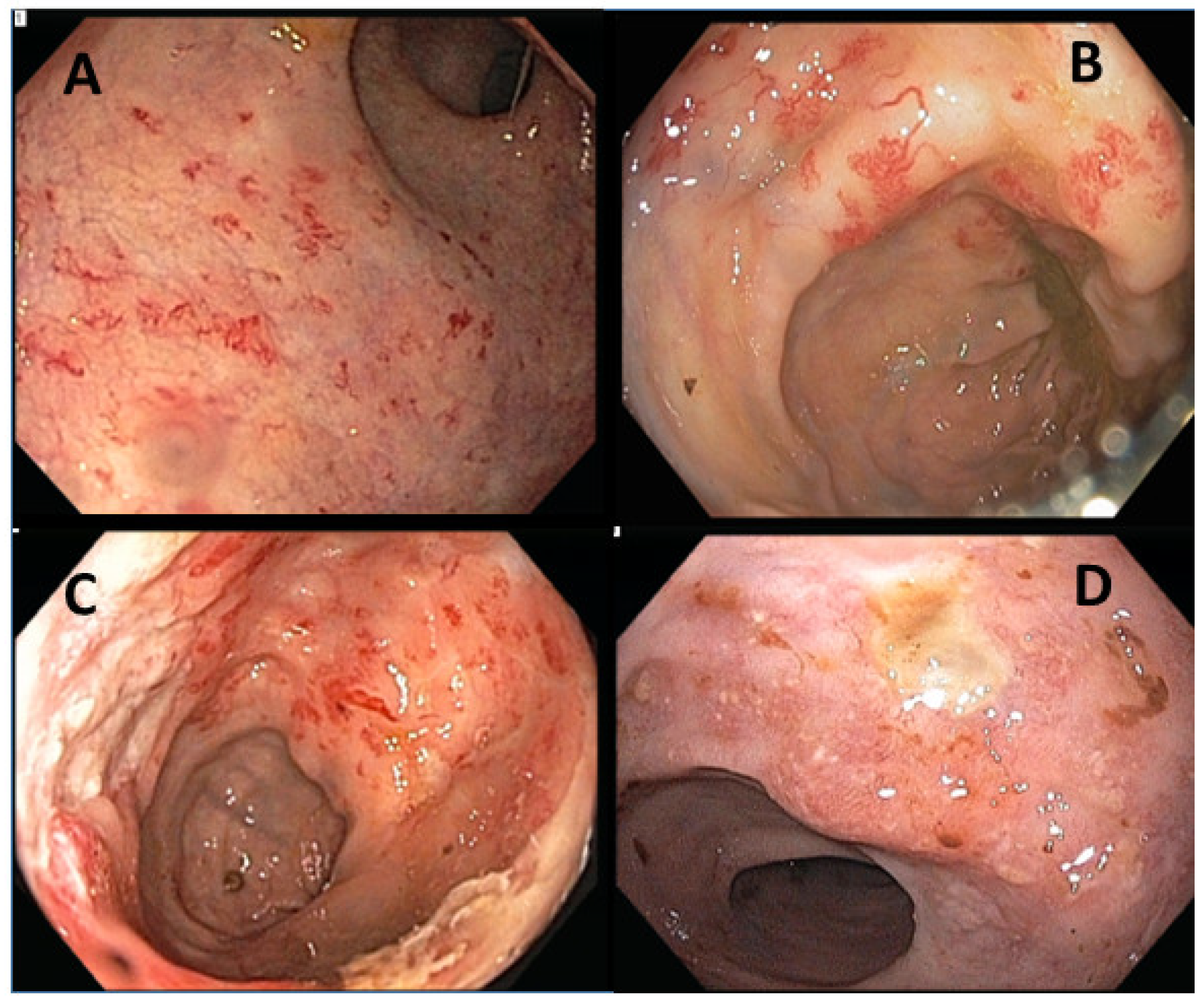 Cancers 15 03160 g001