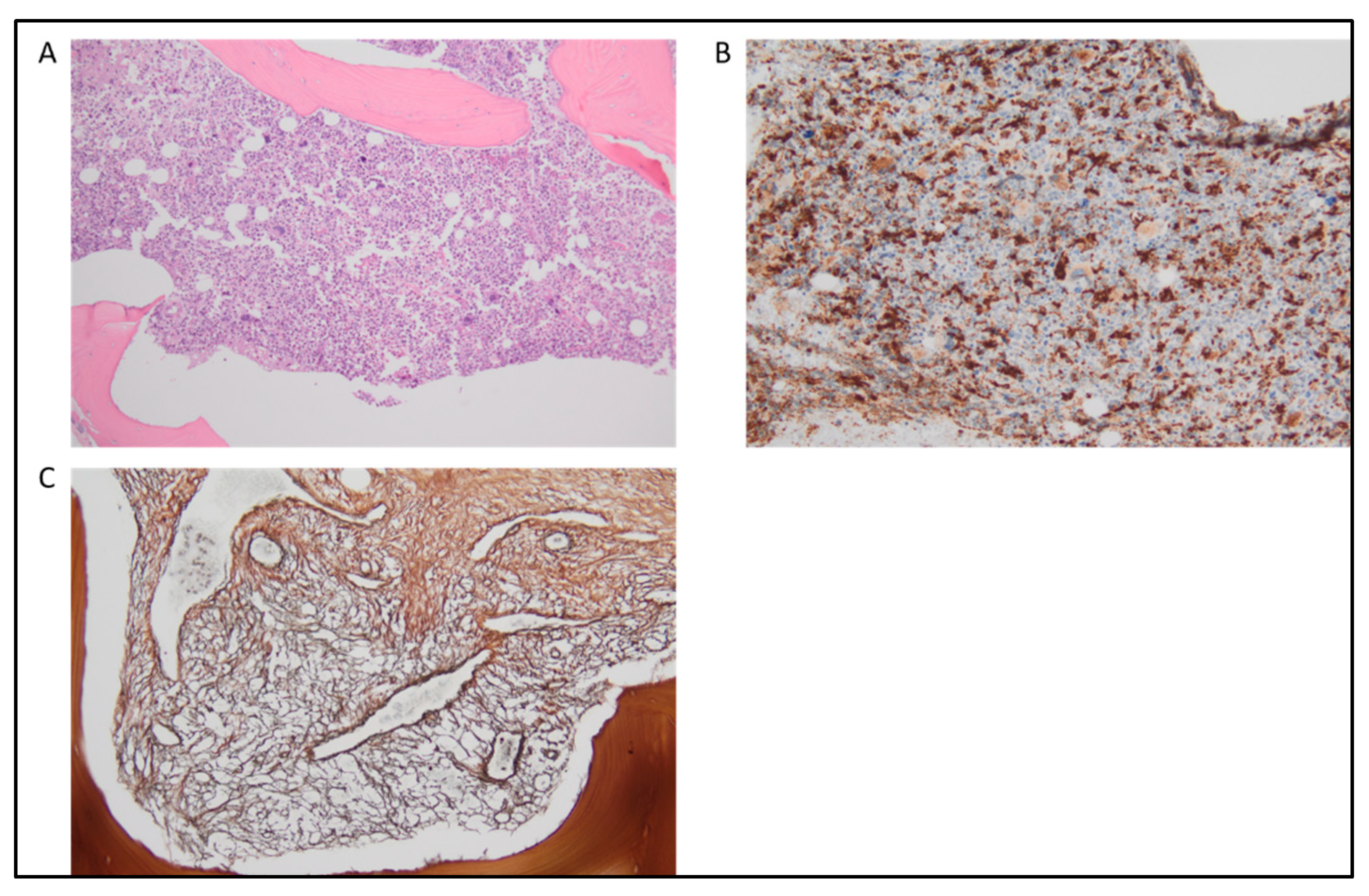 Cancers 15 03175 g001 Cancers 15 03175 g001