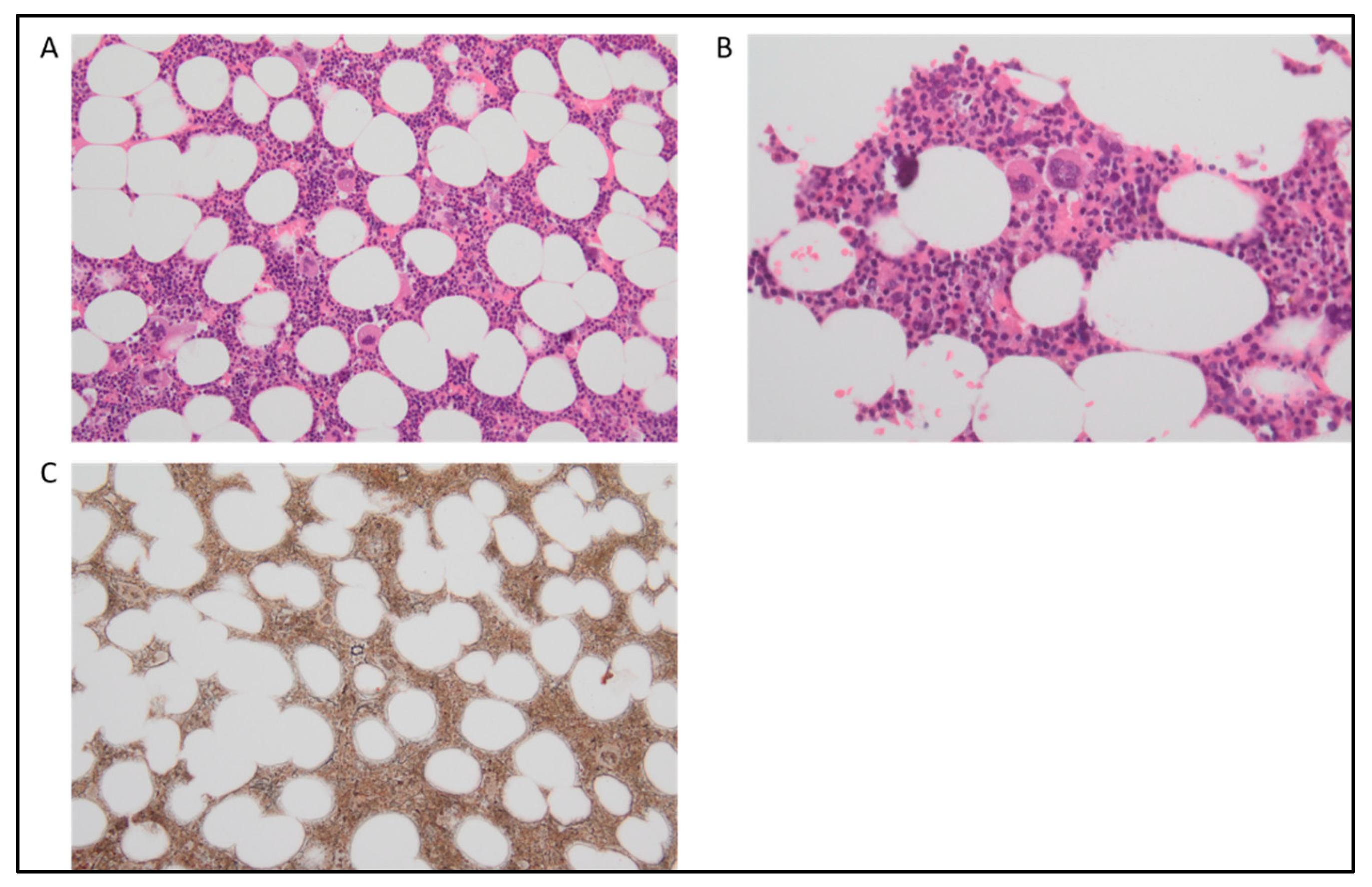 Cancers 15 03175 g002 Cancers 15 03175 g002