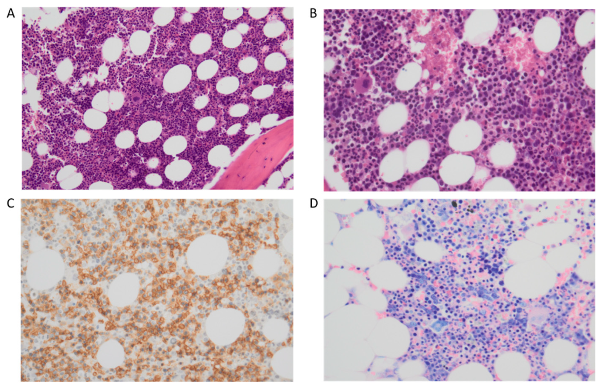 Cancers 15 03175 g003 Cancers 15 03175 g003