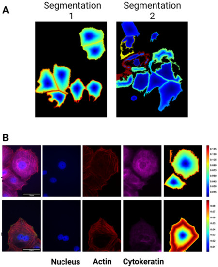 Cancers 15 03186 g0a1