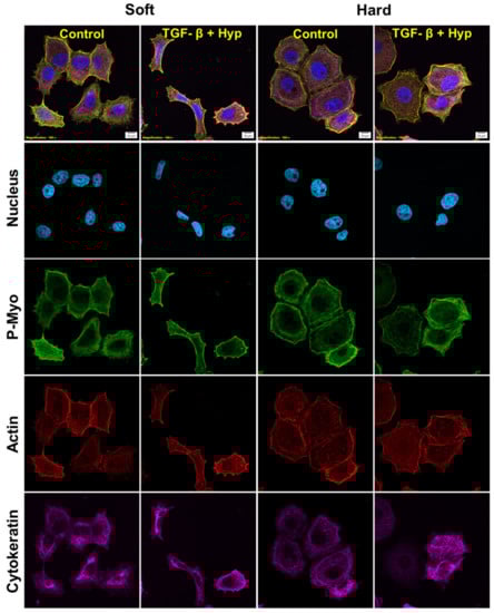 Cancers 15 03186 g0a3
