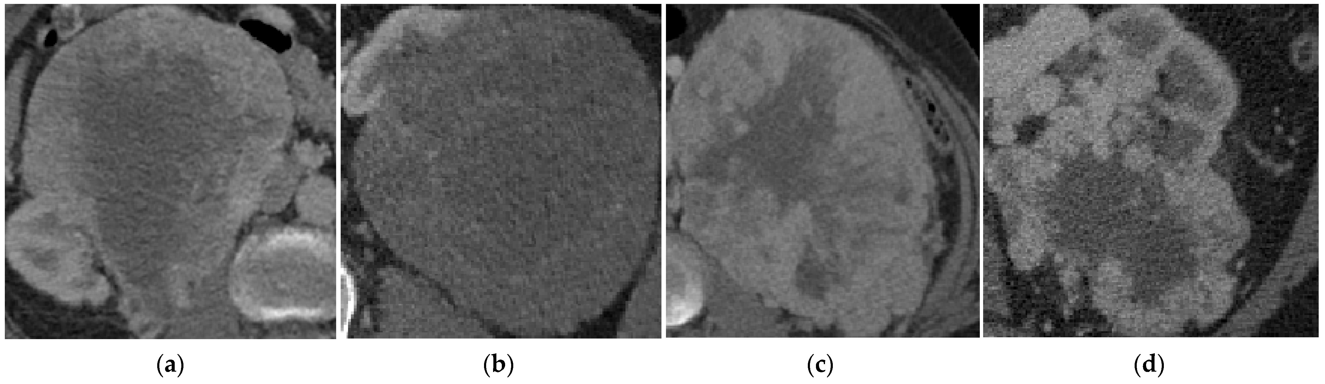 Cancers 15 03189 g003