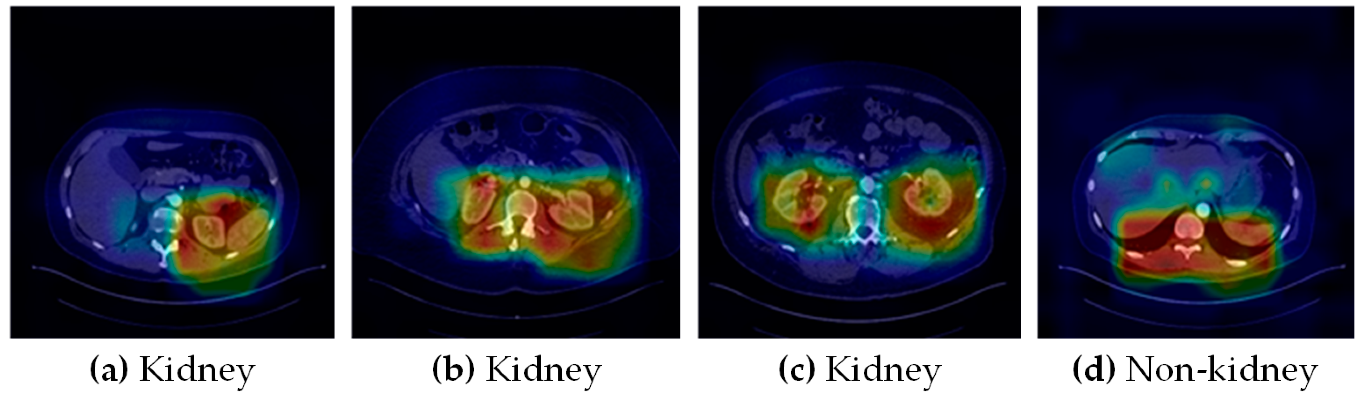 Cancers 15 03189 g005
