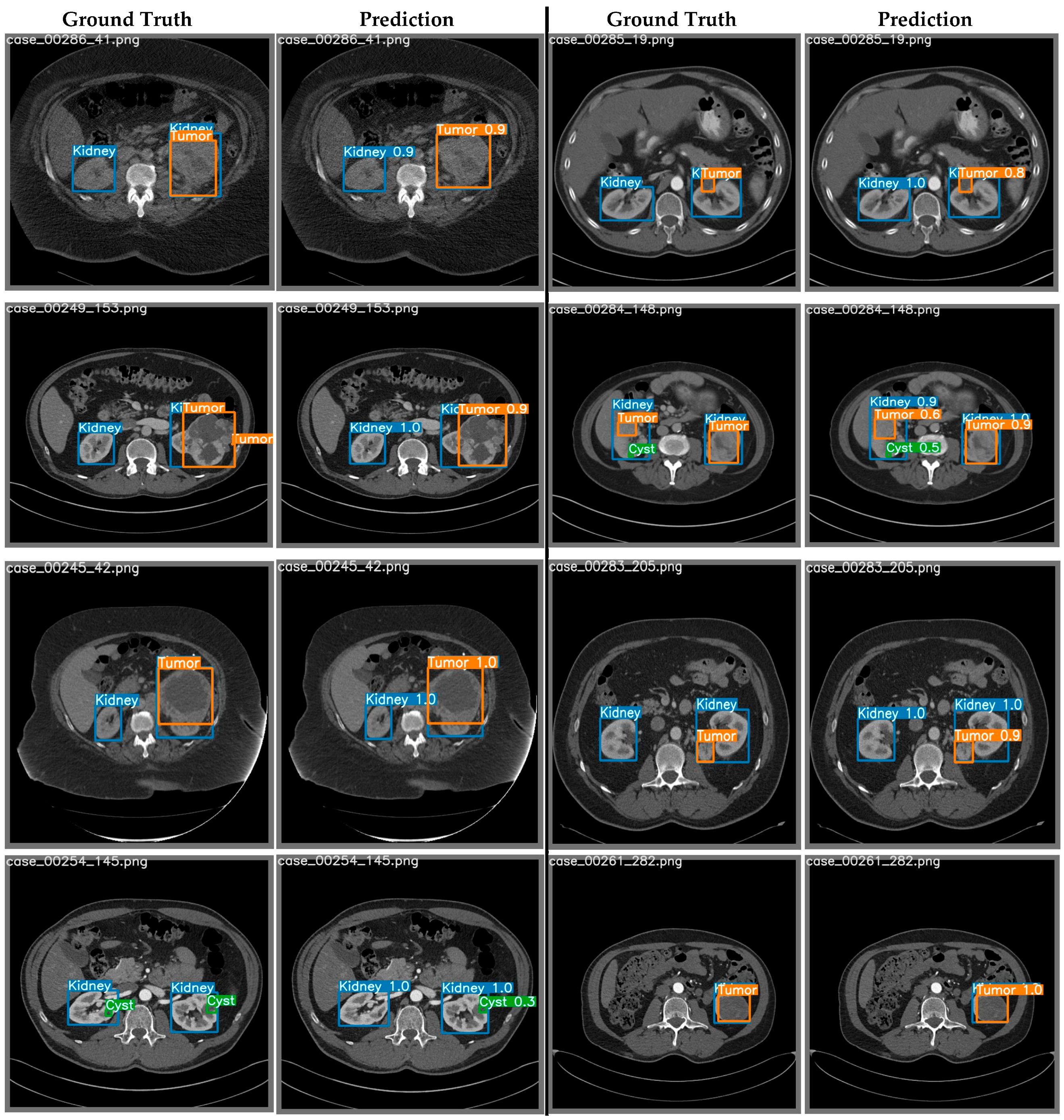 Cancers 15 03189 g006