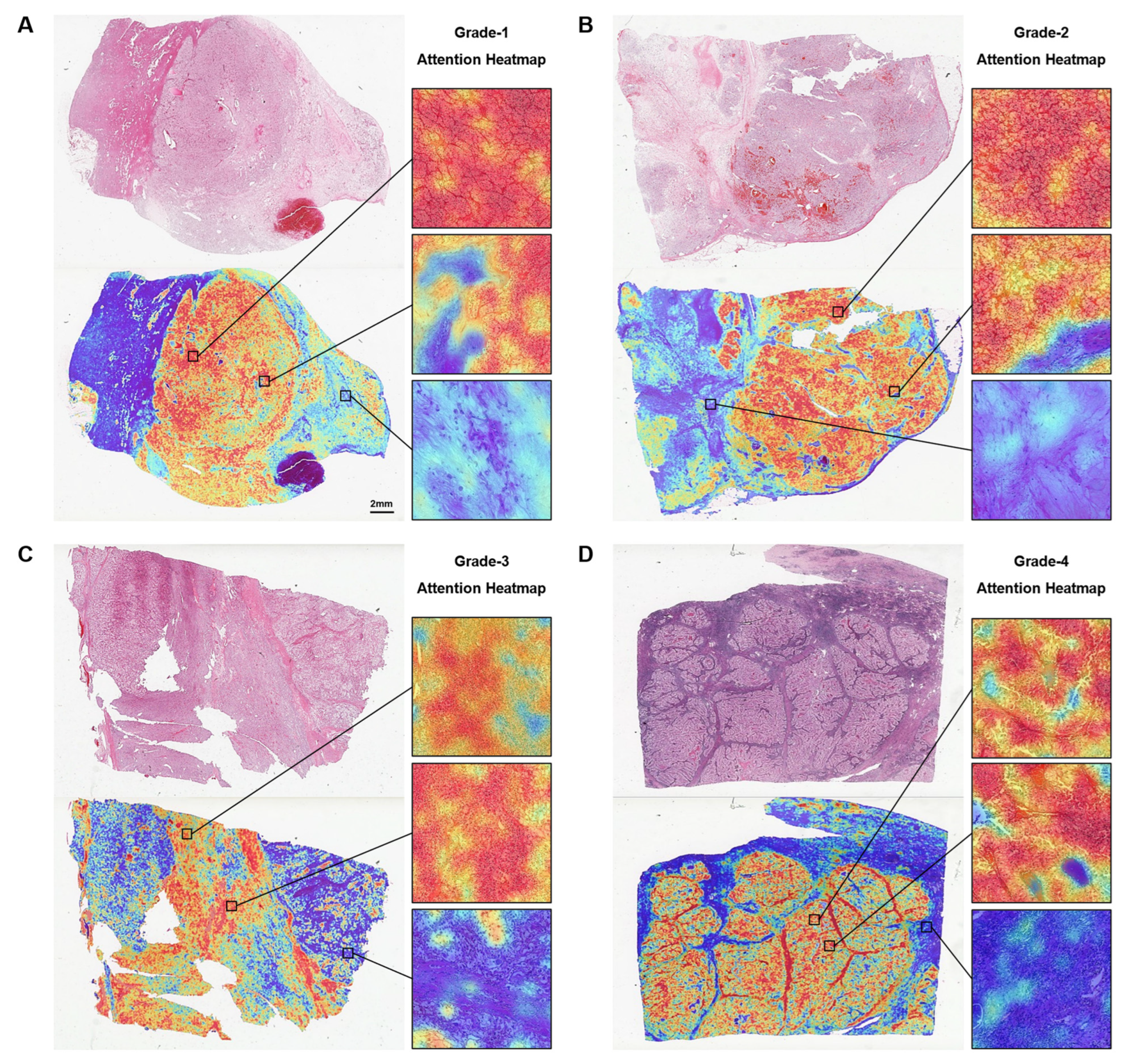 Cancers 15 03198 g005 Cancers 15 03198 g005