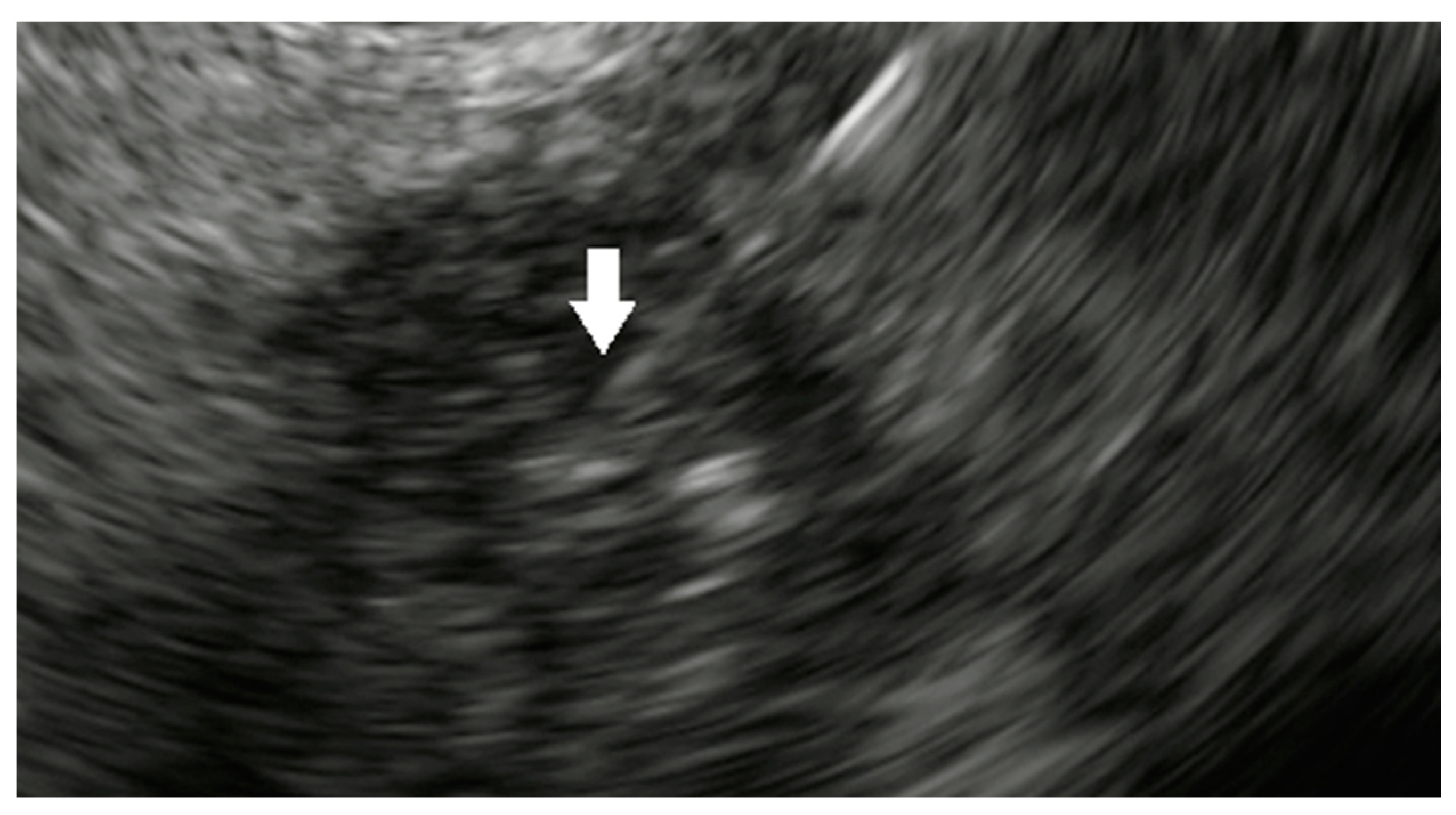 Cancers 15 03235 g001