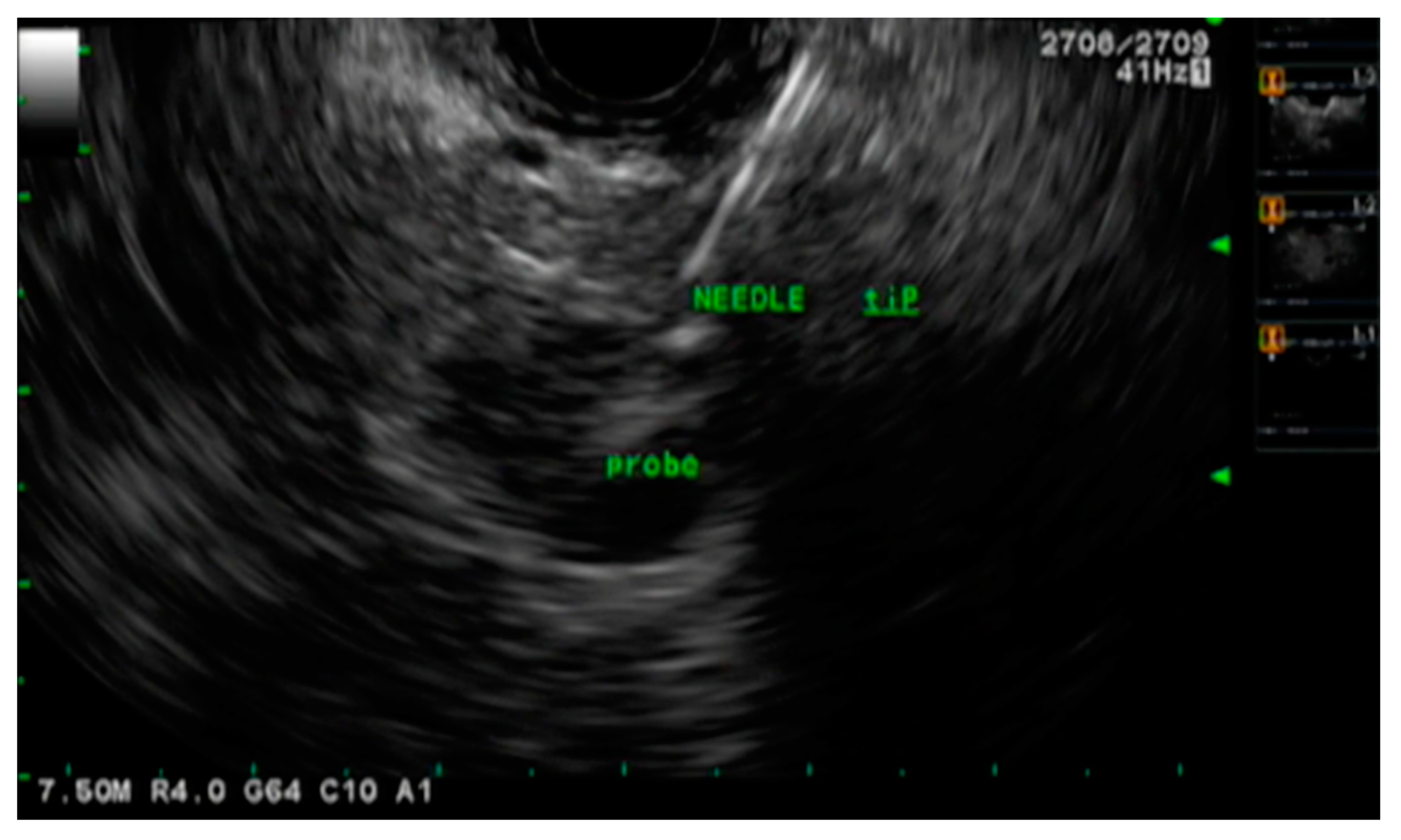 Cancers 15 03235 g003