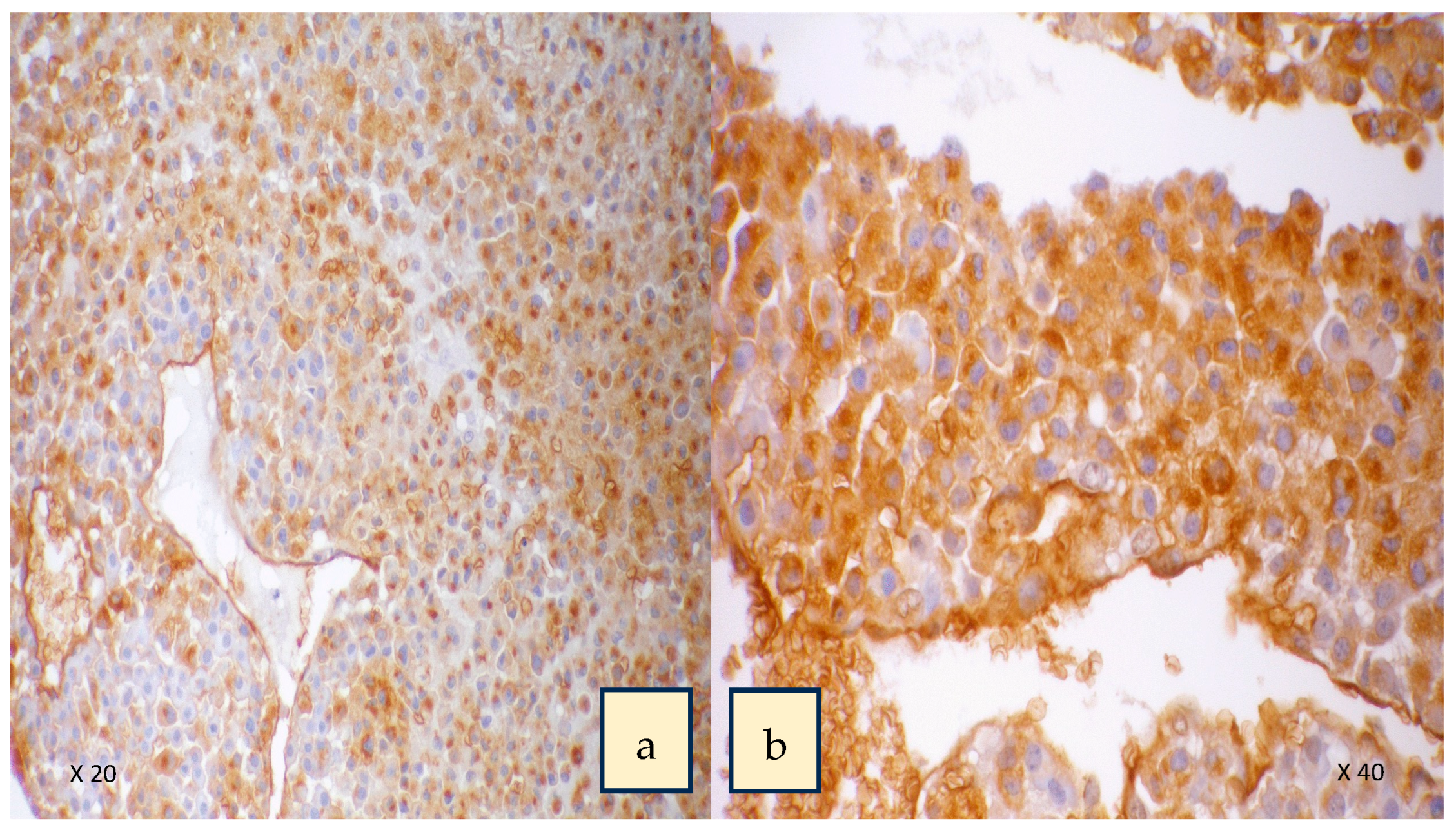 Cancers 15 03266 g004 Cancers 15 03266 g004