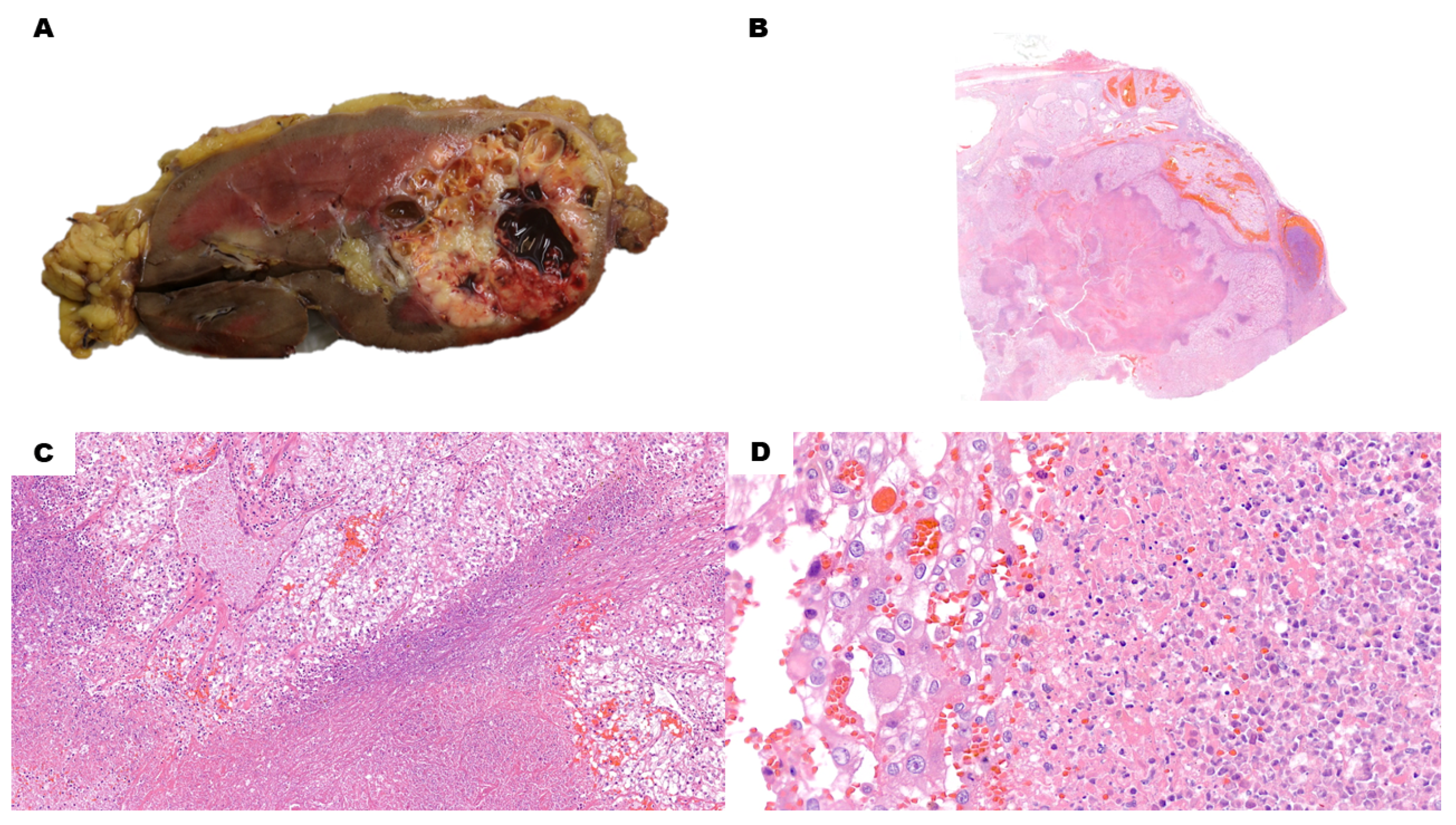 Cancers 15 03352 g002