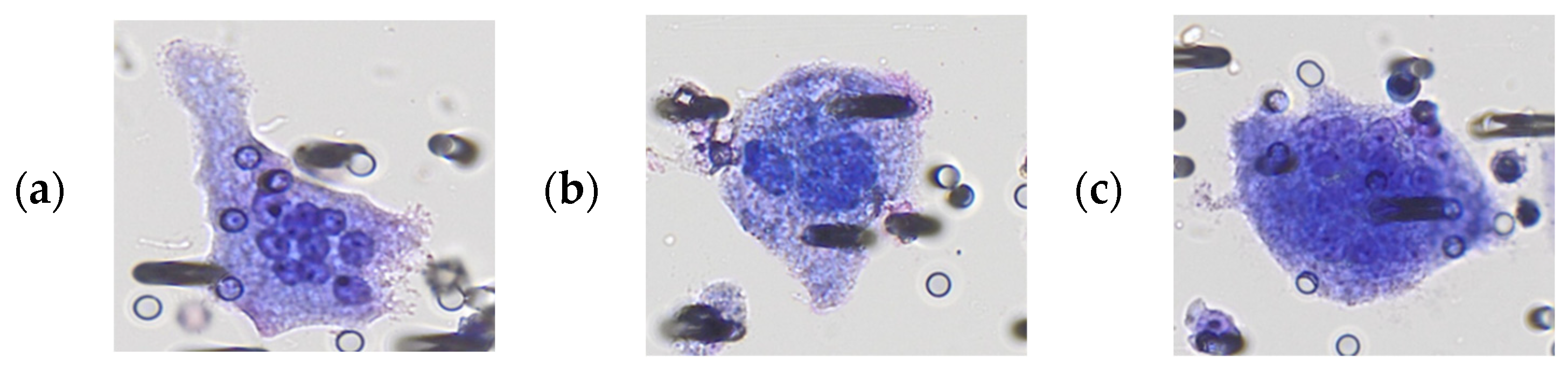 Cancers 15 03366 g001a