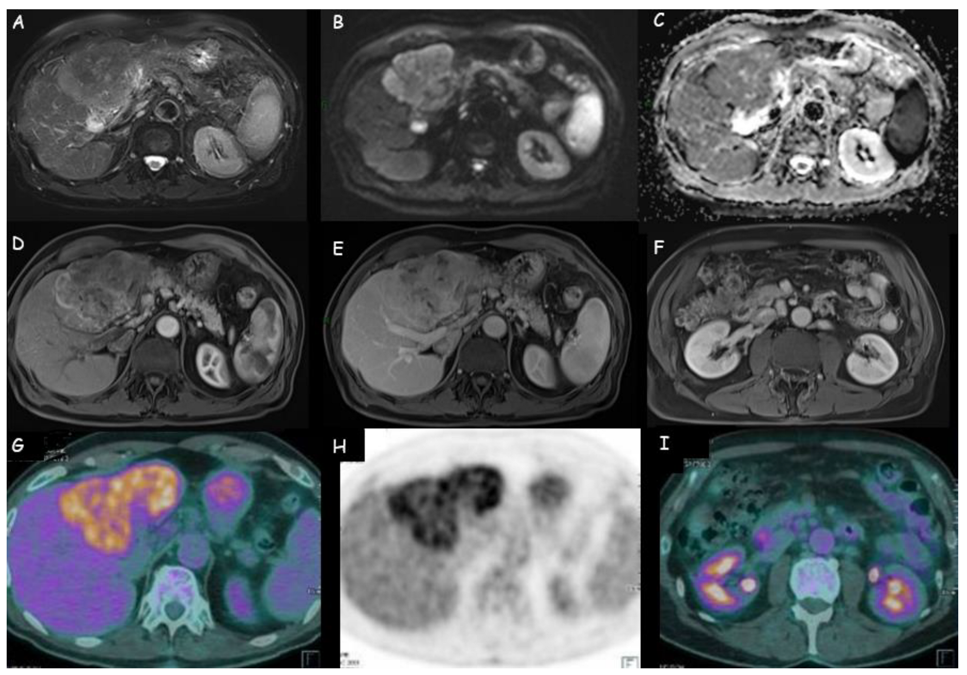 Cancers 15 03393 g004 Cancers 15 03393 g004