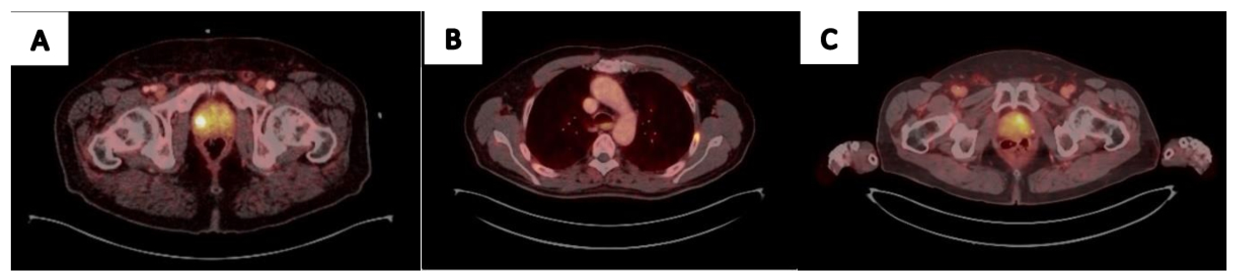 Cancers 15 03402 g002