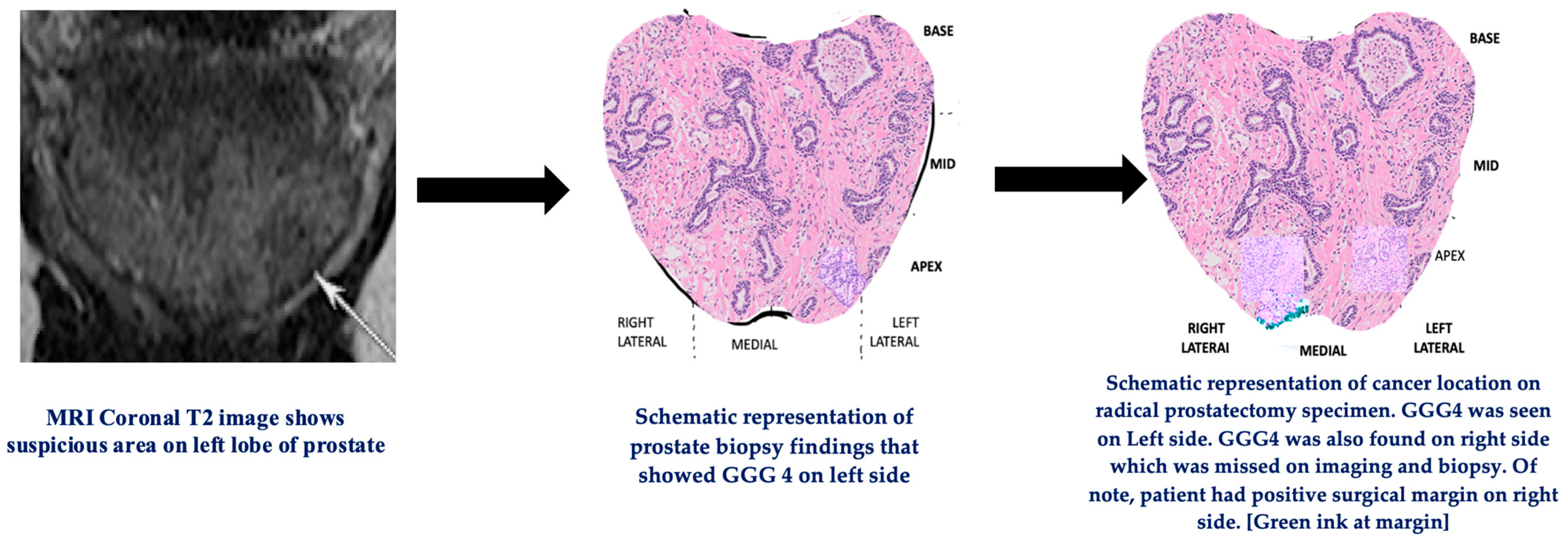 Cancers 15 03487 g004