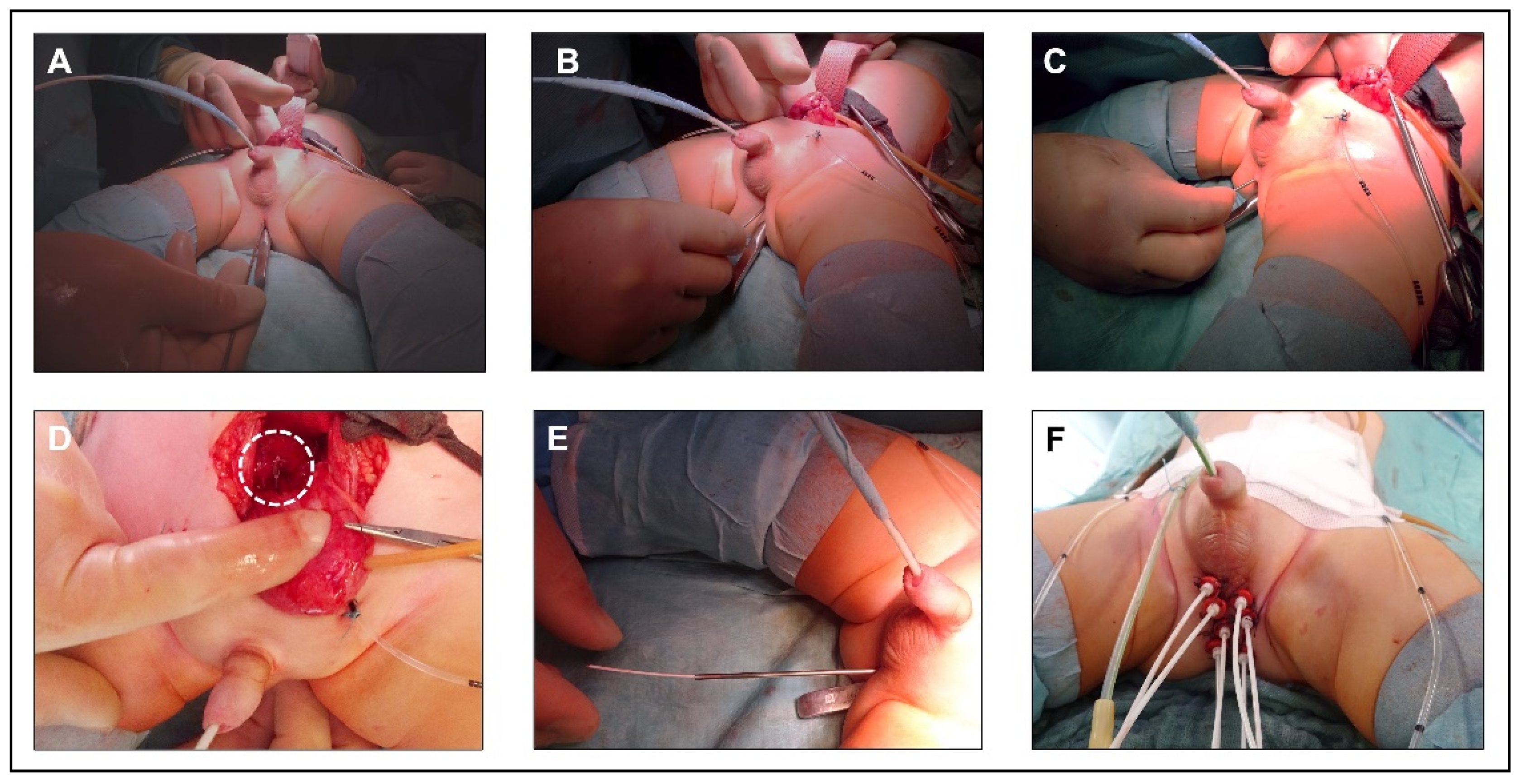 Cancers 15 03505 g001