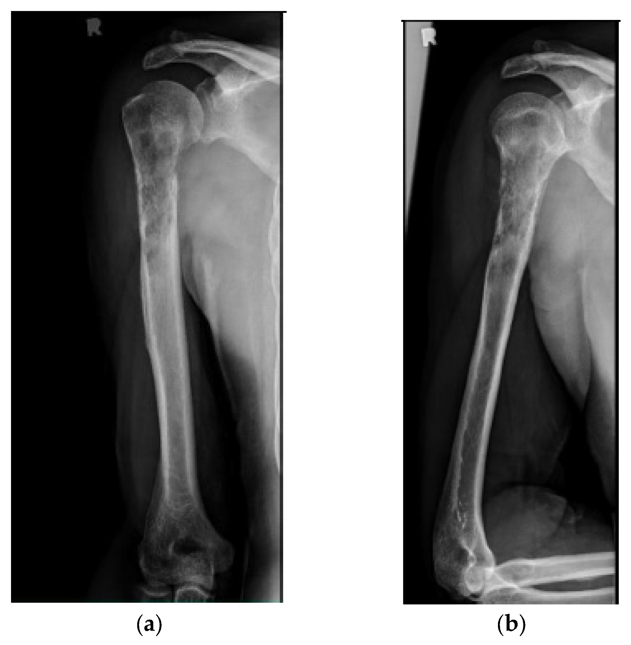 Cancers 15 03601 g002a