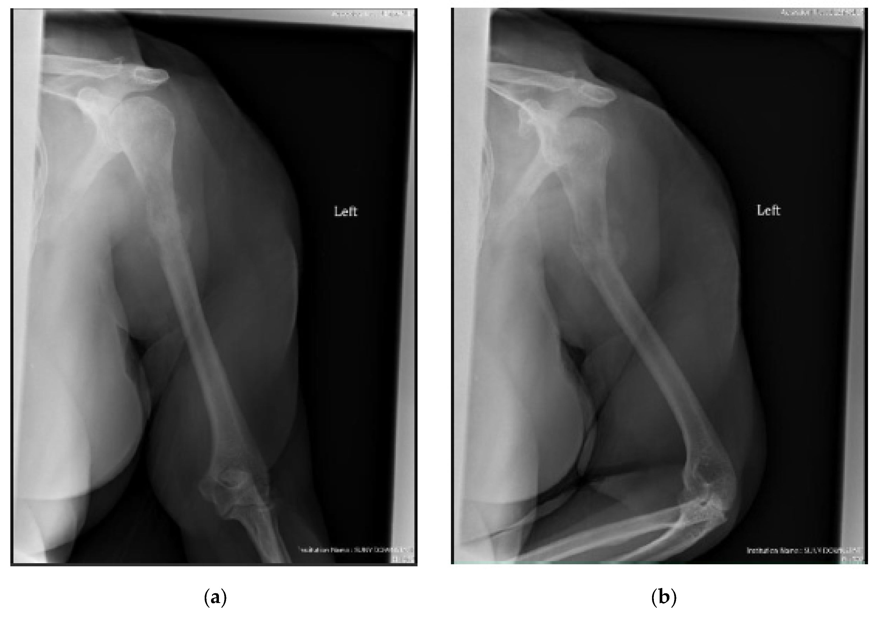 Cancers 15 03601 g003a