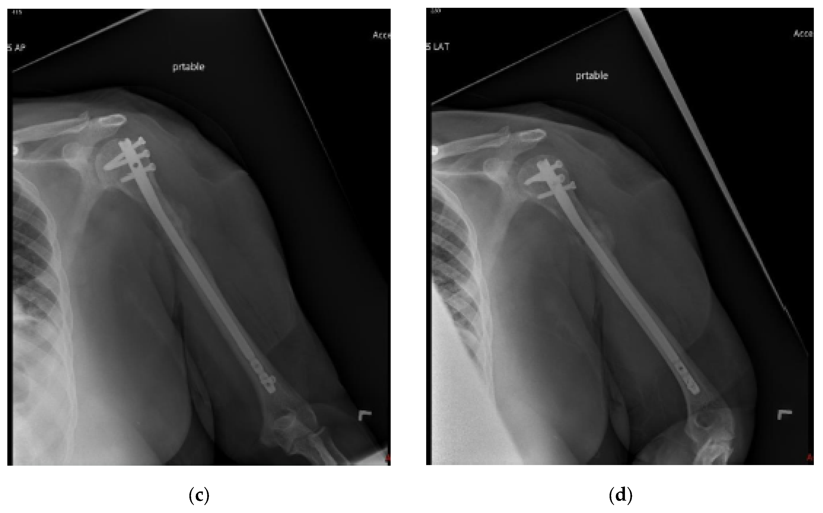 Cancers 15 03601 g003b