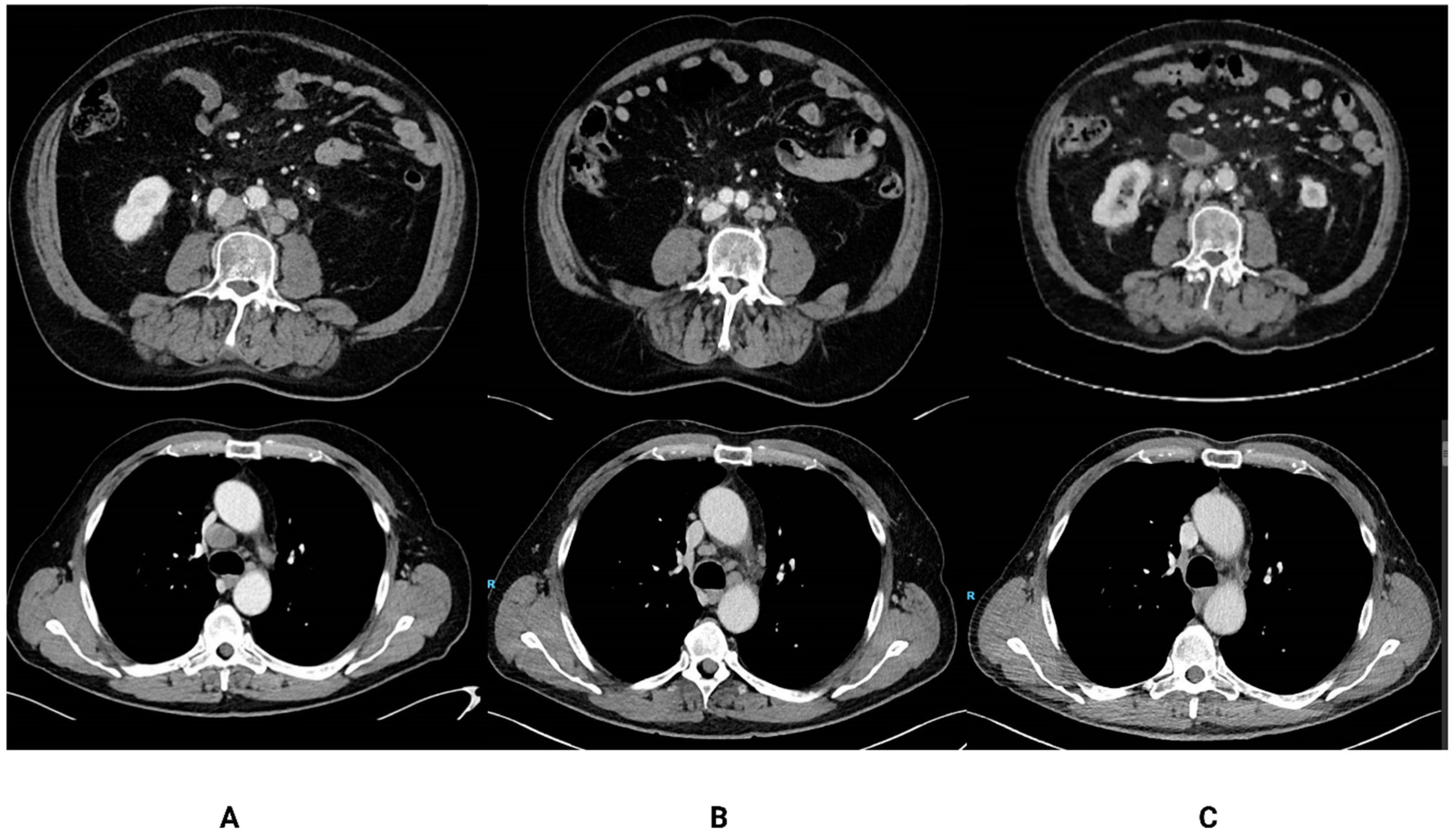 Cancers 15 03654 g002